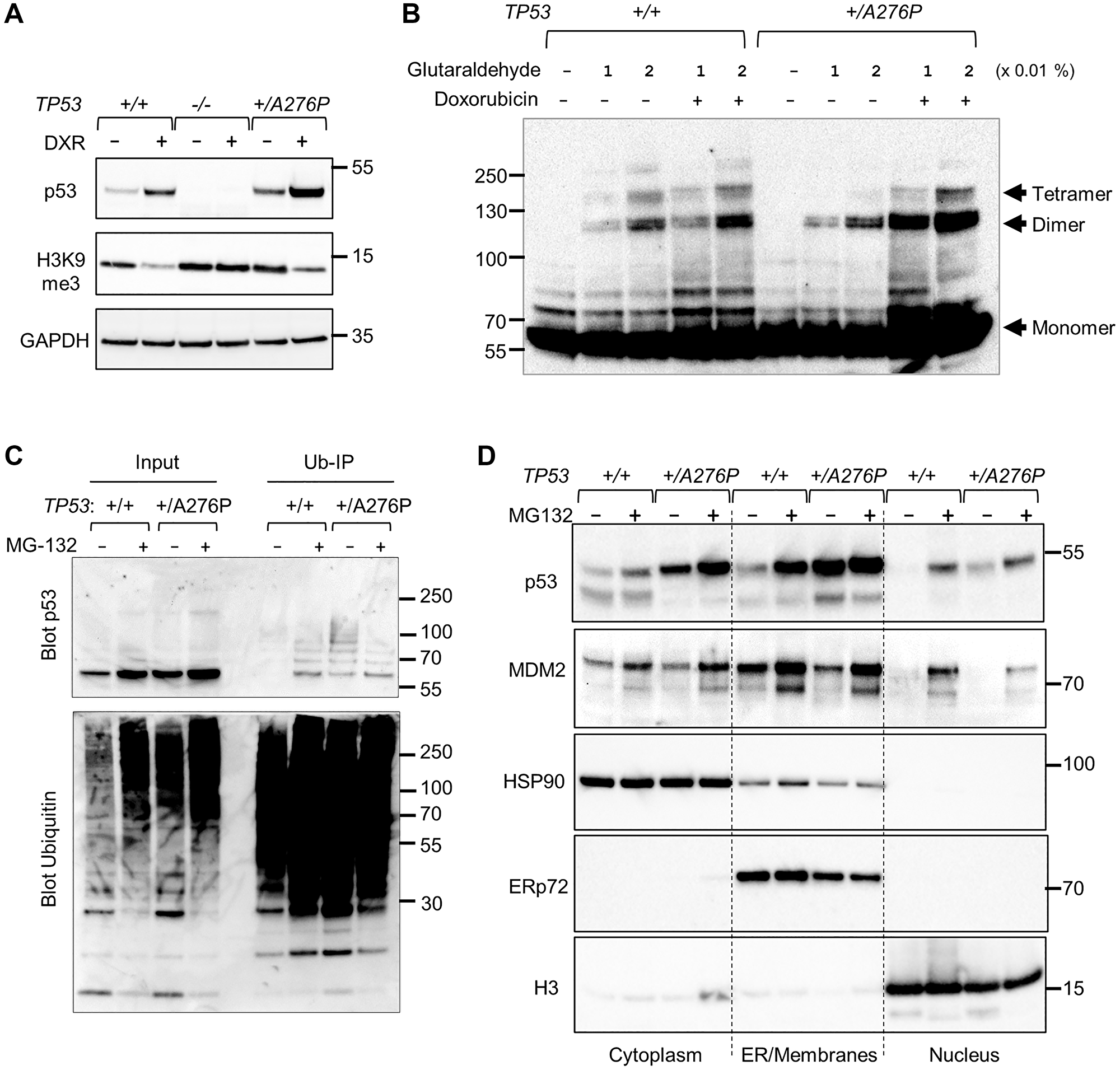 Impact of p53 A276P mutant on oligomerization and subcellular localization