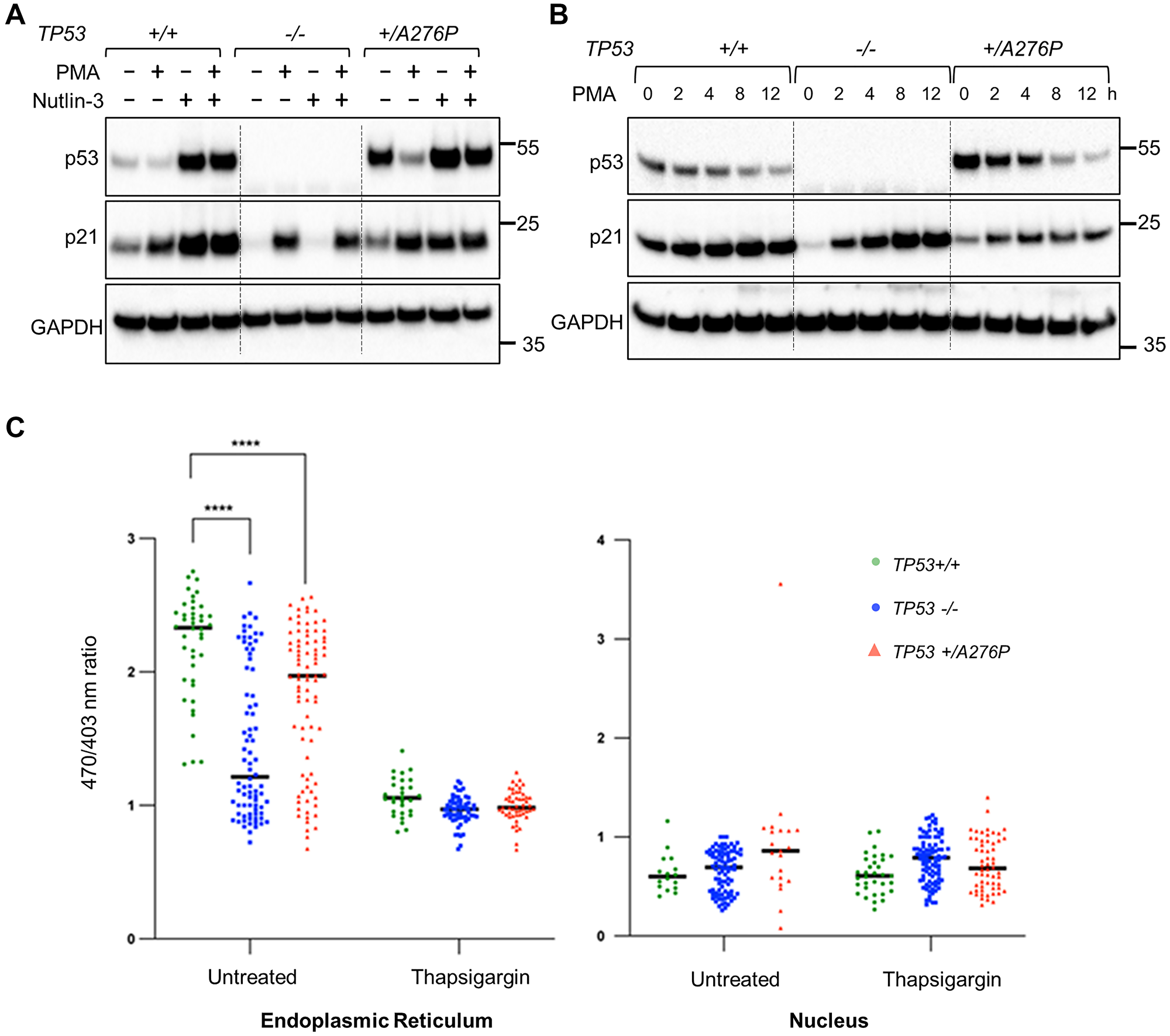 Upstream and downstream effects of p53 on intracellular Ca2+ signaling