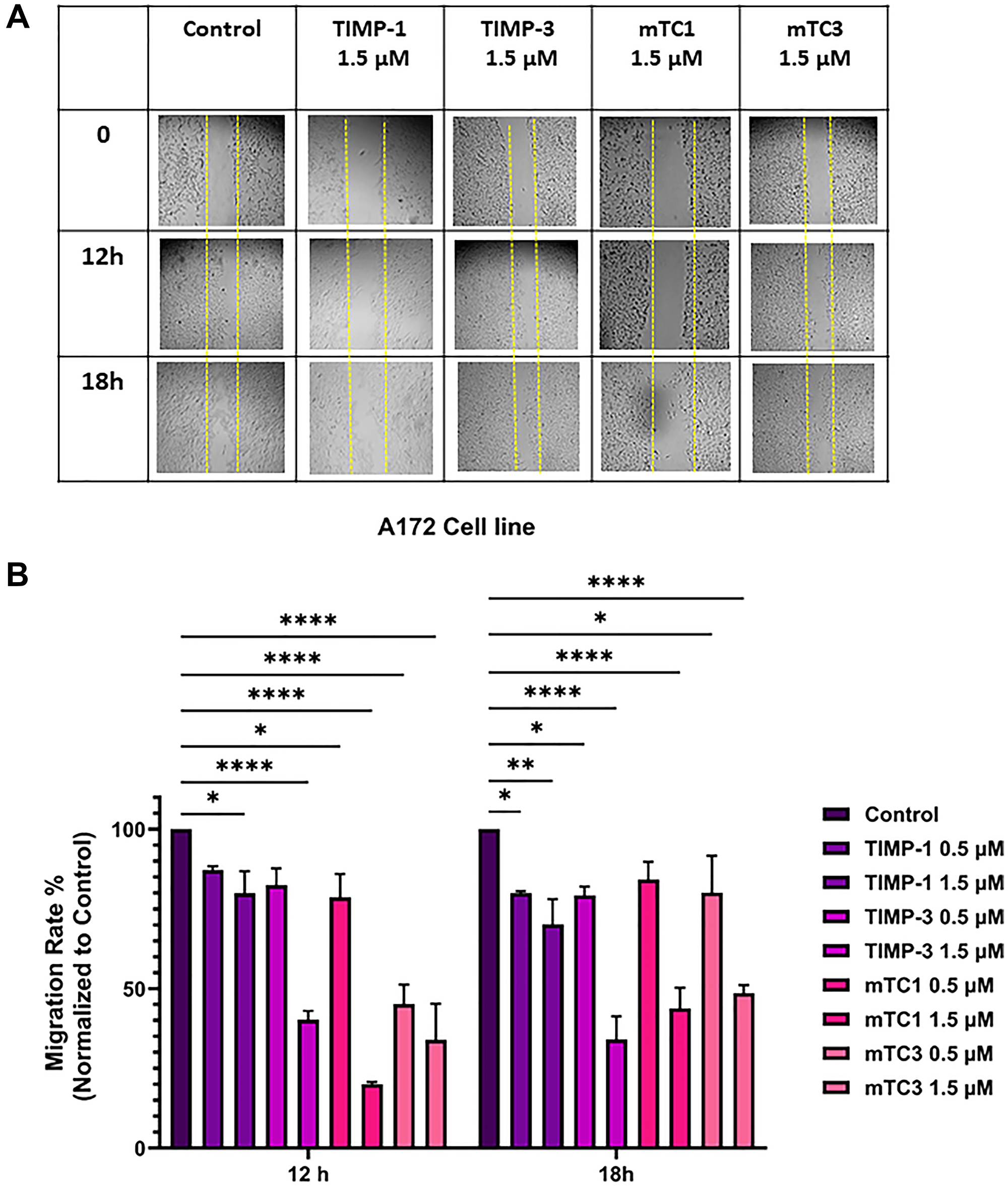 Effect of TIMPs and minimal TIMPs variants on migration of the A172 cell line