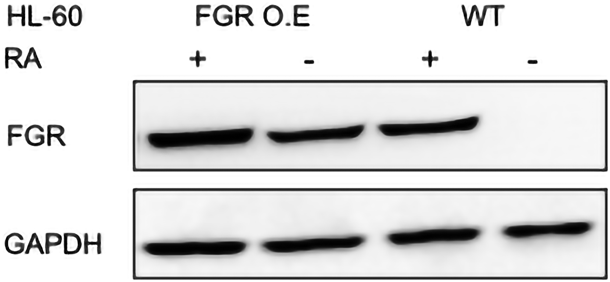 FGR Western blot analysis of HL-60 wt and FGR O.E cells untreated and treated with RA