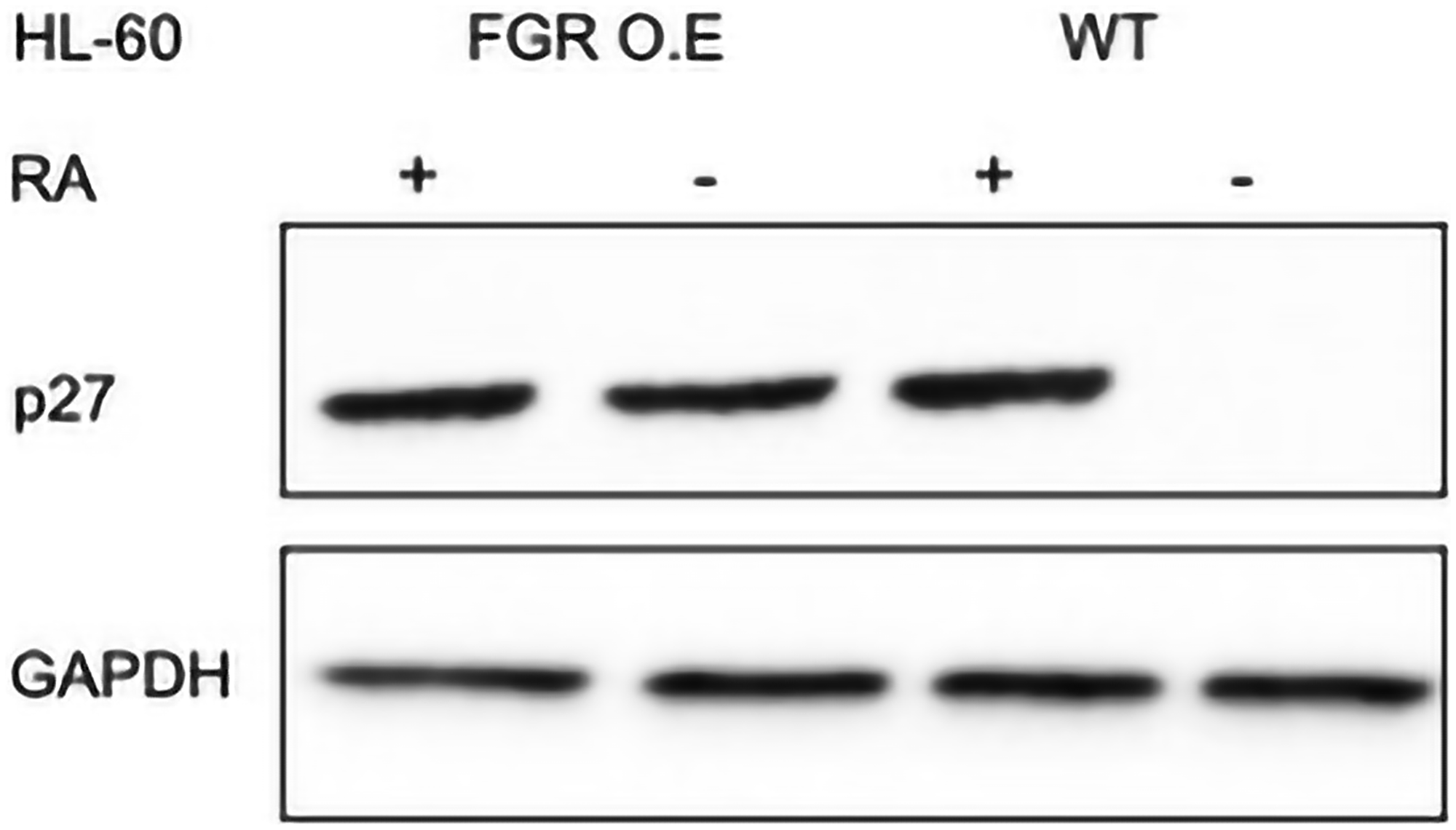 p27 Western blot analysis of HL-60 wt and FGR O.E cells untreated and treated with RA