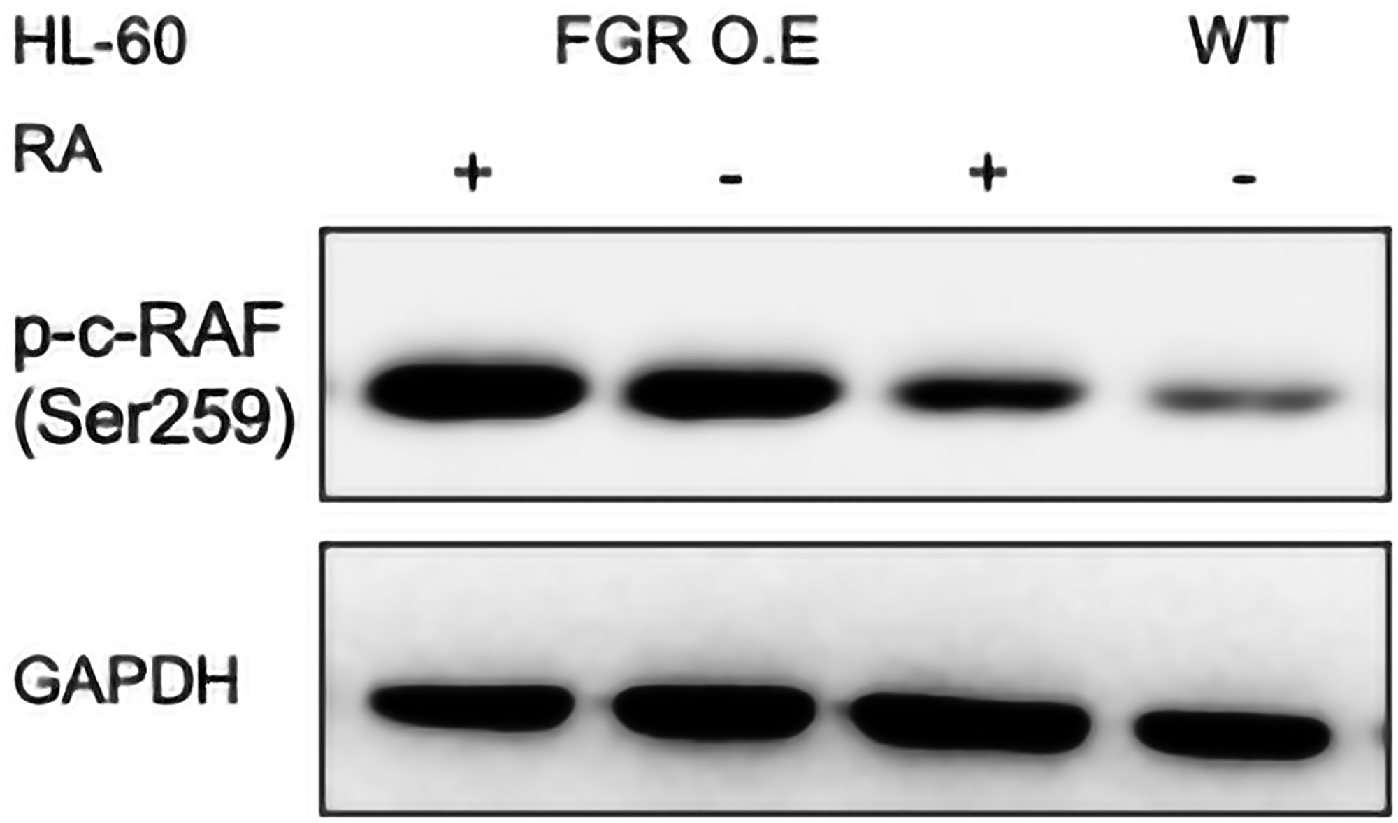 p-c-RAF (Ser259) Western blot analysis of HL-60 wt and FGR O.E cells untreated and treated with RA