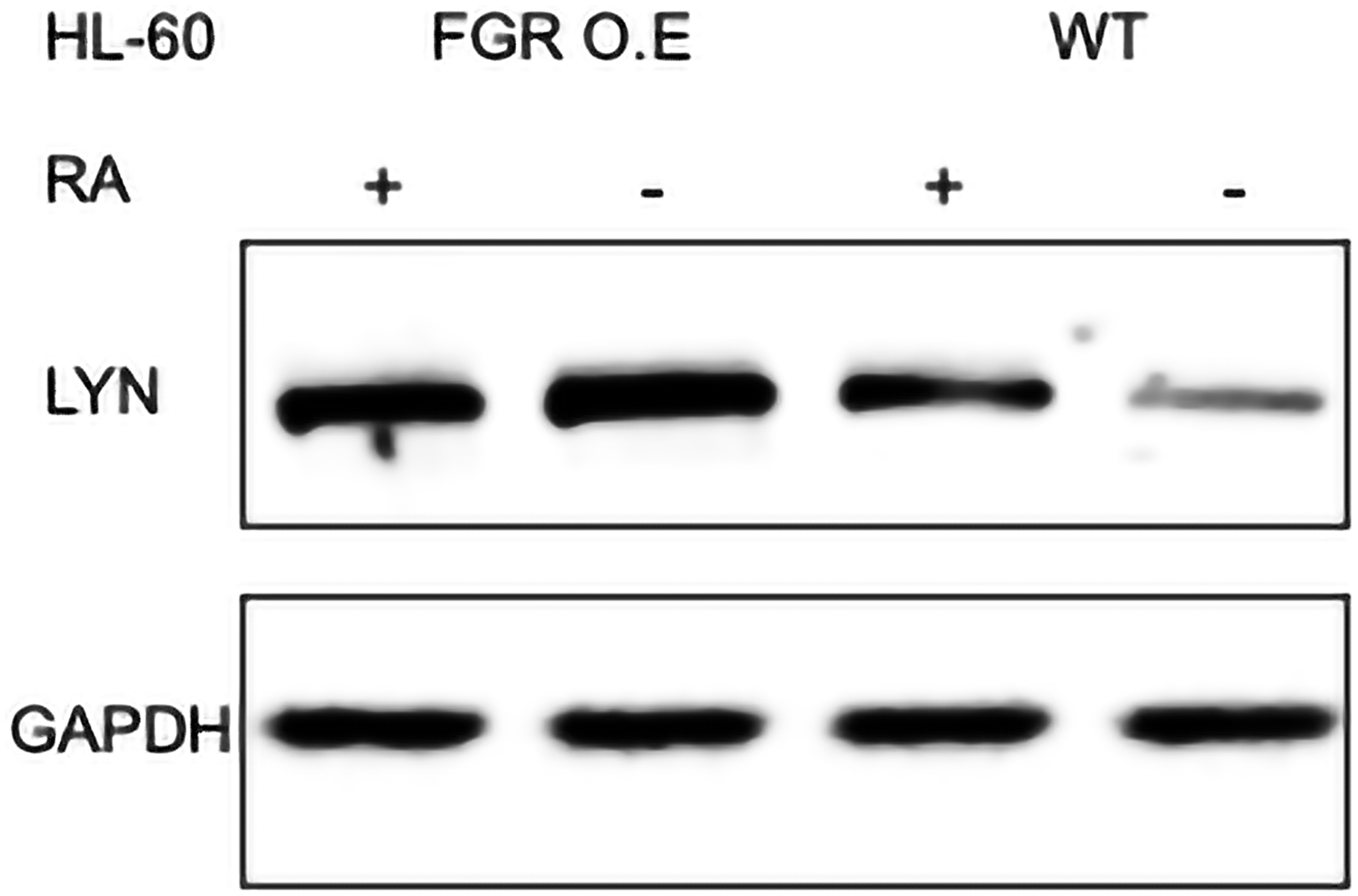 LYN Western blot analysis of HL-60 wt and FGR O.E cells untreated and treated with RA