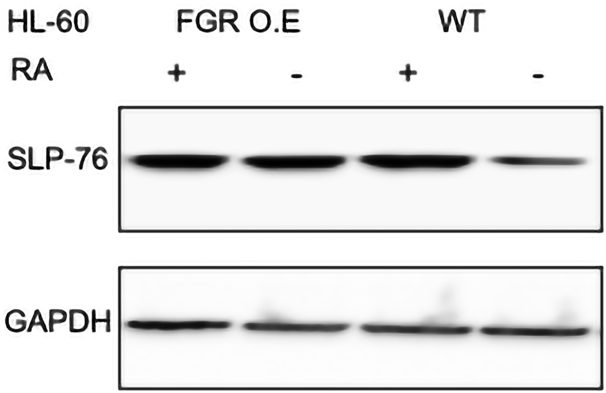 SLP-76 Western blot analysis of HL-60 wt and FGR O.E cells untreated and treated with RA