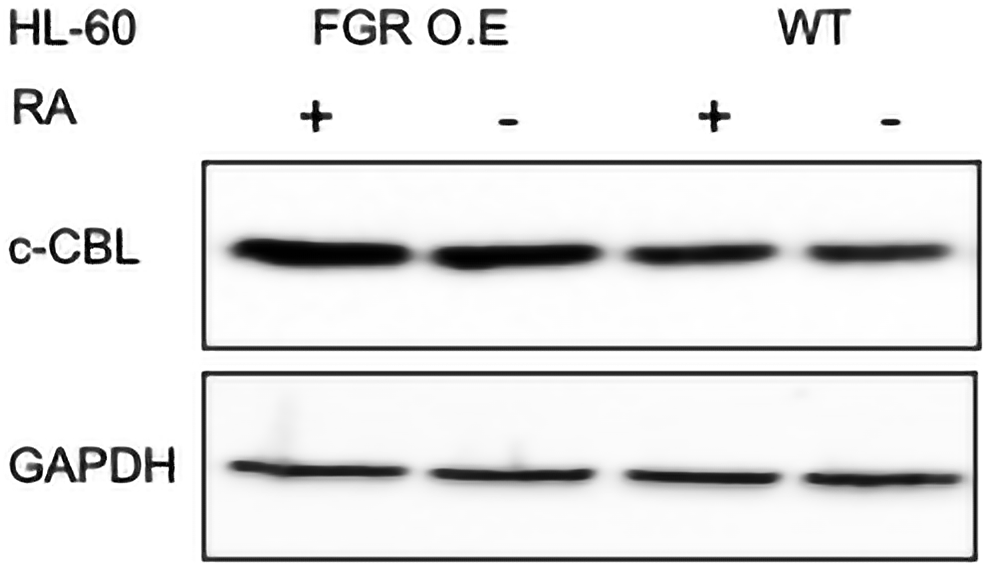 c-CBL Western blot analysis of HL-60 wt and FGR O.E cells untreated and treated with RA