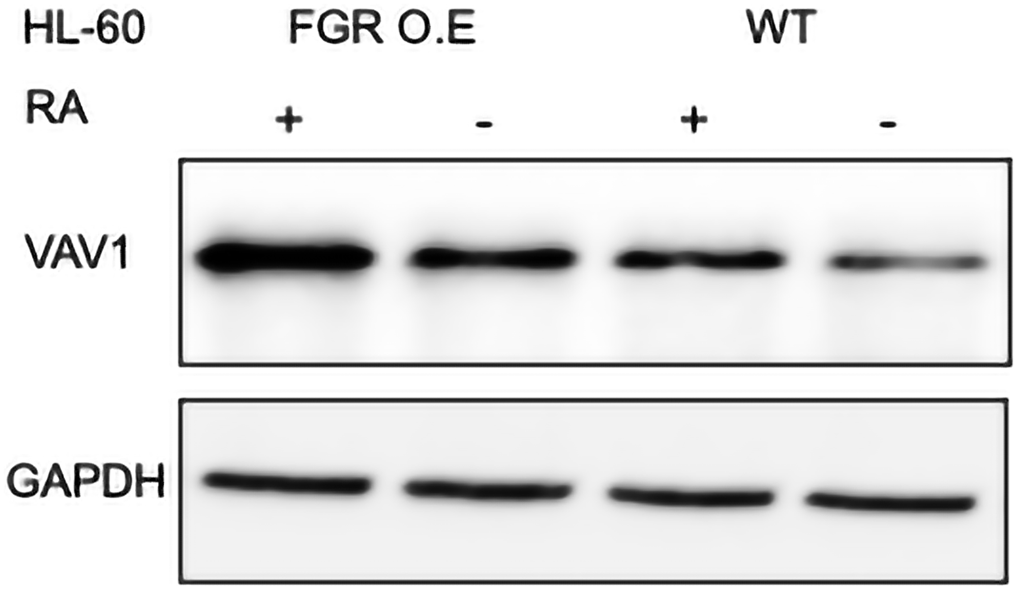 VAV1 Western blot analysis of HL-60 wt and FGR O.E cells untreated and treated with RA