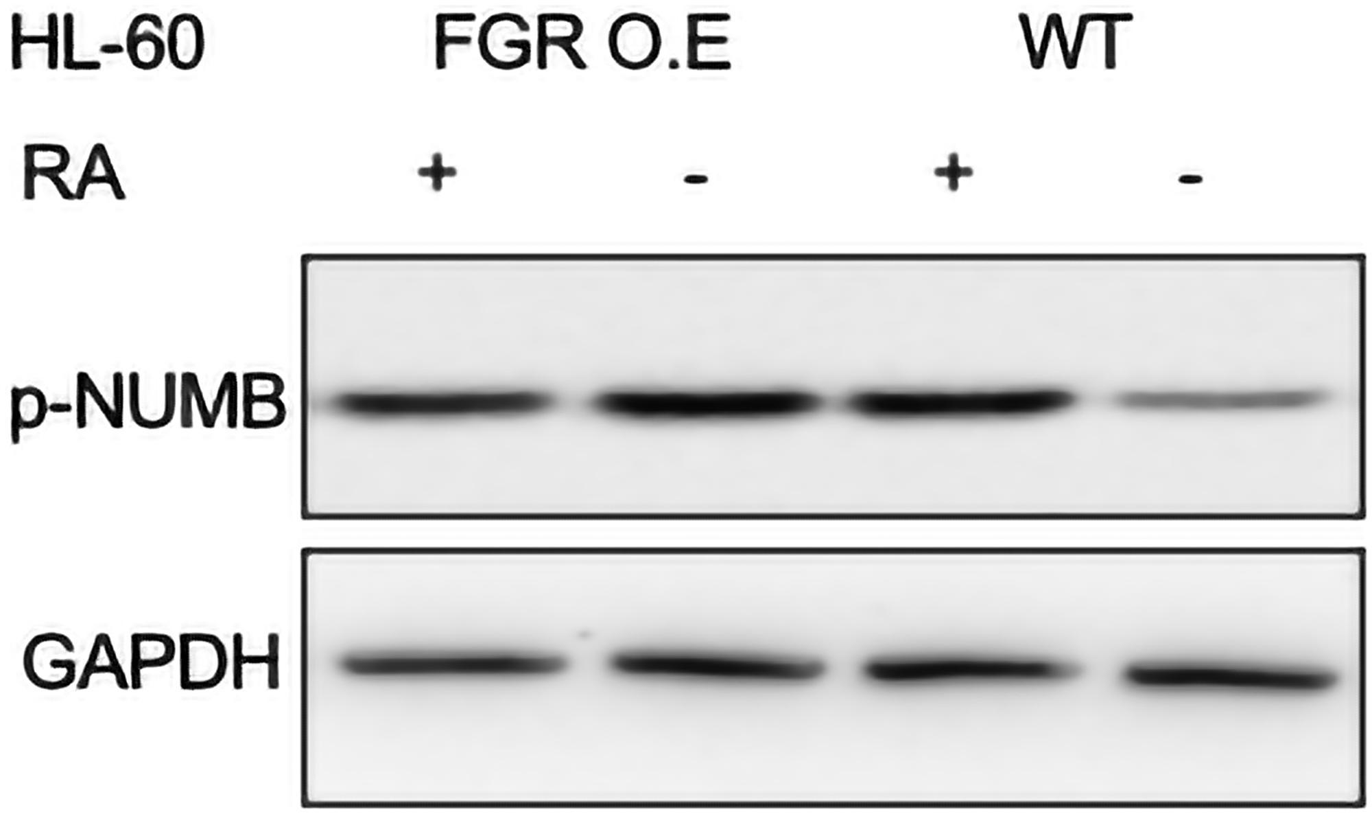 p-NUMB Western blot analysis of HL-60 wt and FGR O.E cells untreated and treated with RA