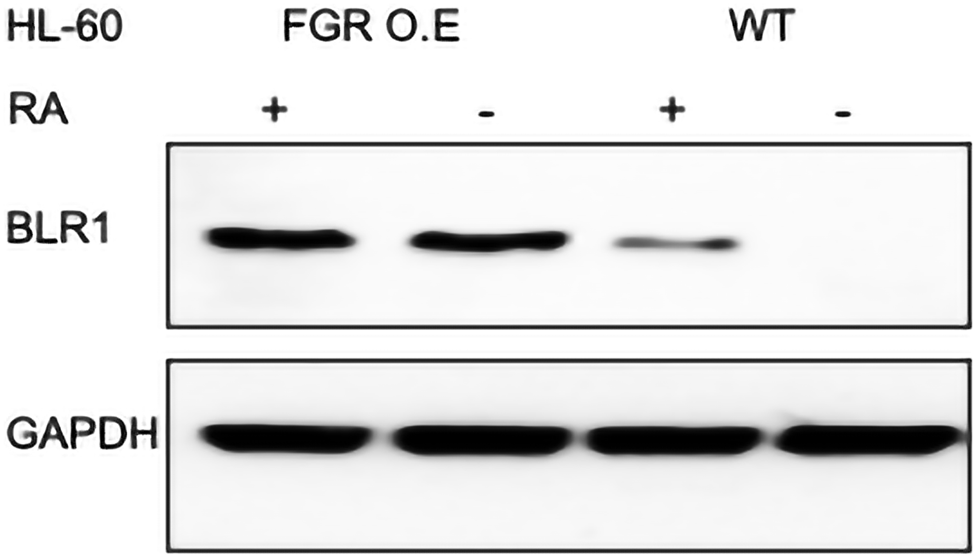 BLR1 Western blot analysis of HL-60 wt and FGR O.E cells untreated and treated with RA