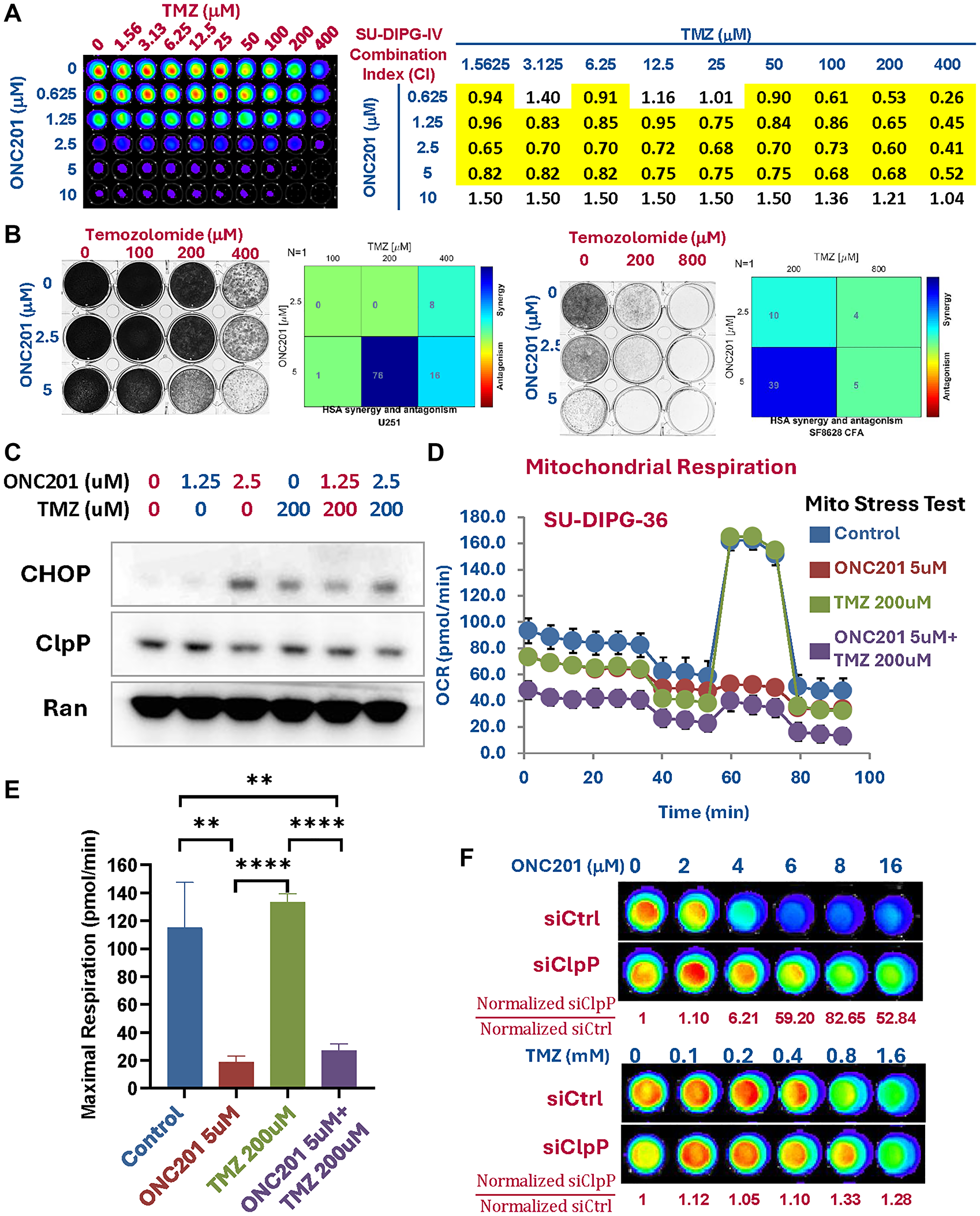 ONC201 synergizes with TMZ