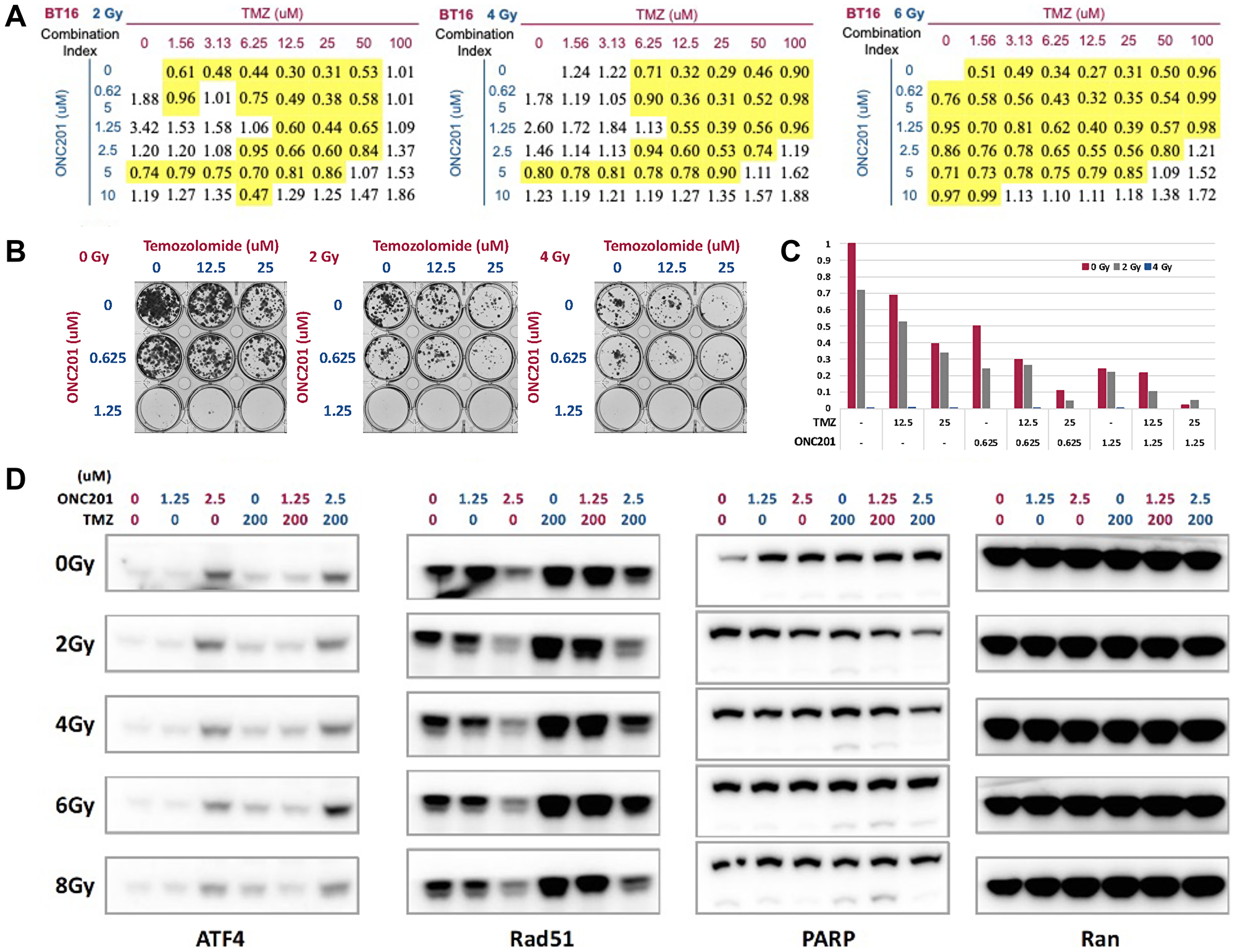 IRT triple combination of ONC201 with RT and TMZ synergizes in brain tumor cells