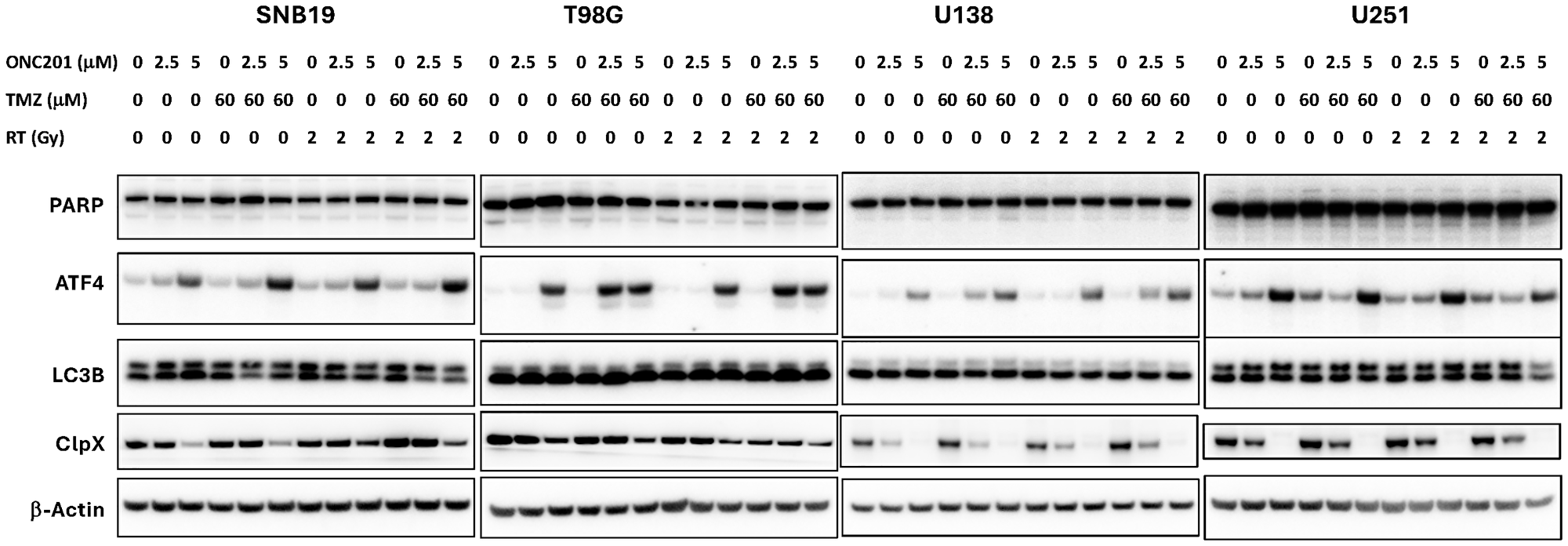 IRT triple combination of ONC201, TMZ and RT shows strong synergy, induces ATF as marker of ISR activation, and inhibits ClpX to unleash ClpP in SNB19, T98G, U138, and U251 GBM cells