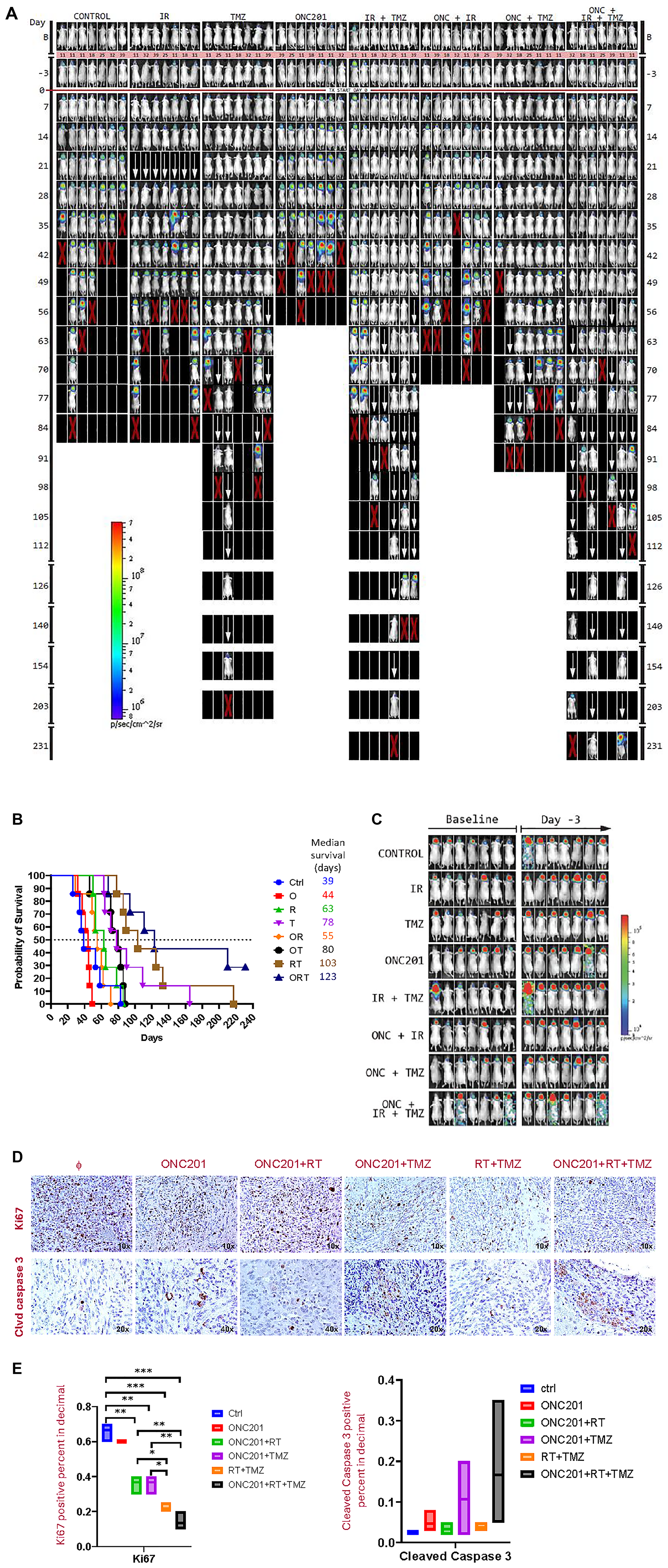 IRT triple combination of ONC201, RT, and TMZ for 4 weeks significantly prolongs mouse survival and reduces tumor burden in an orthotopic brain tumor model