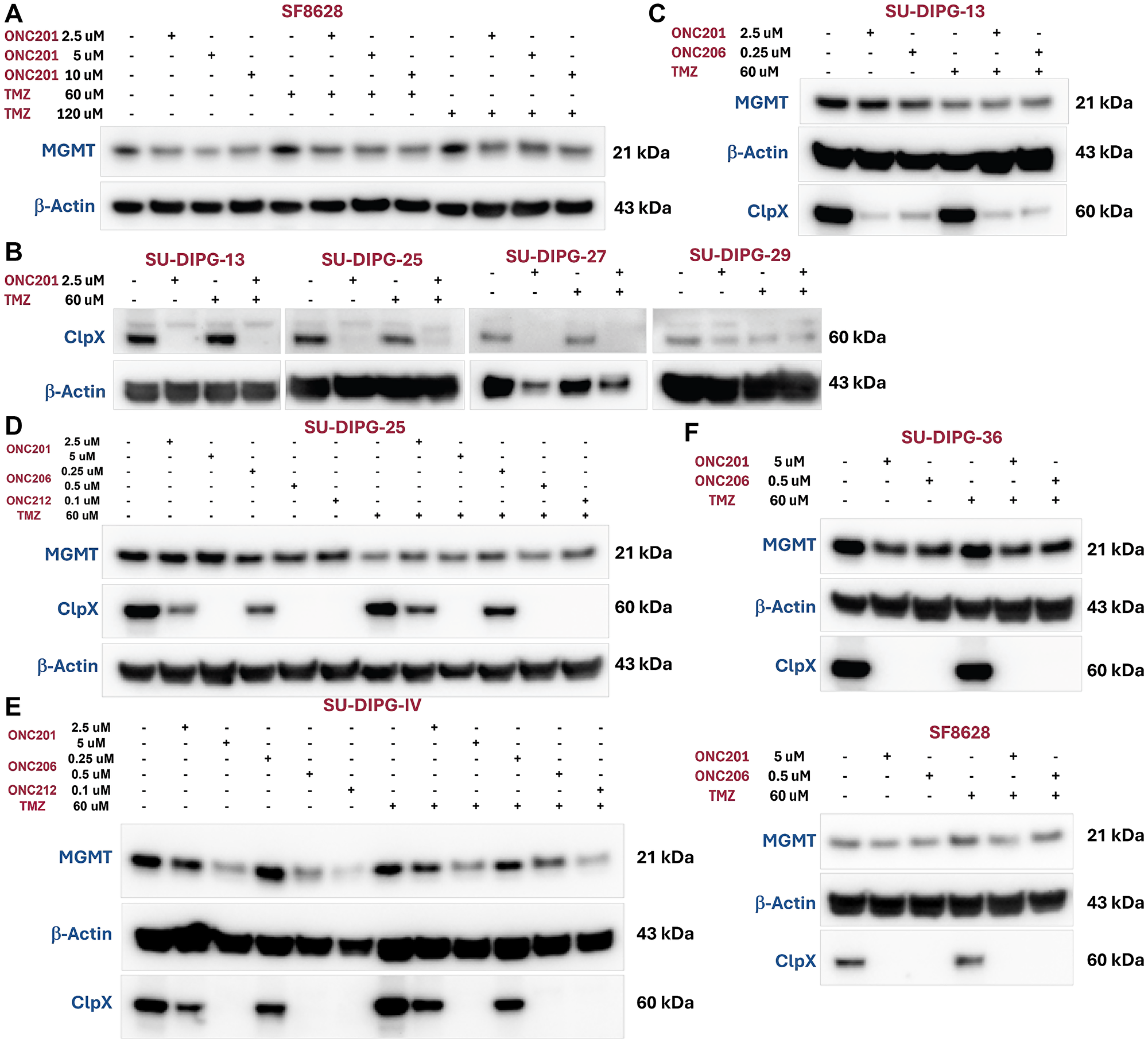 Imipridones (ONC201, ONC206 and ONC212) modulate MGMT and ClpX expression in DIPG cell lines