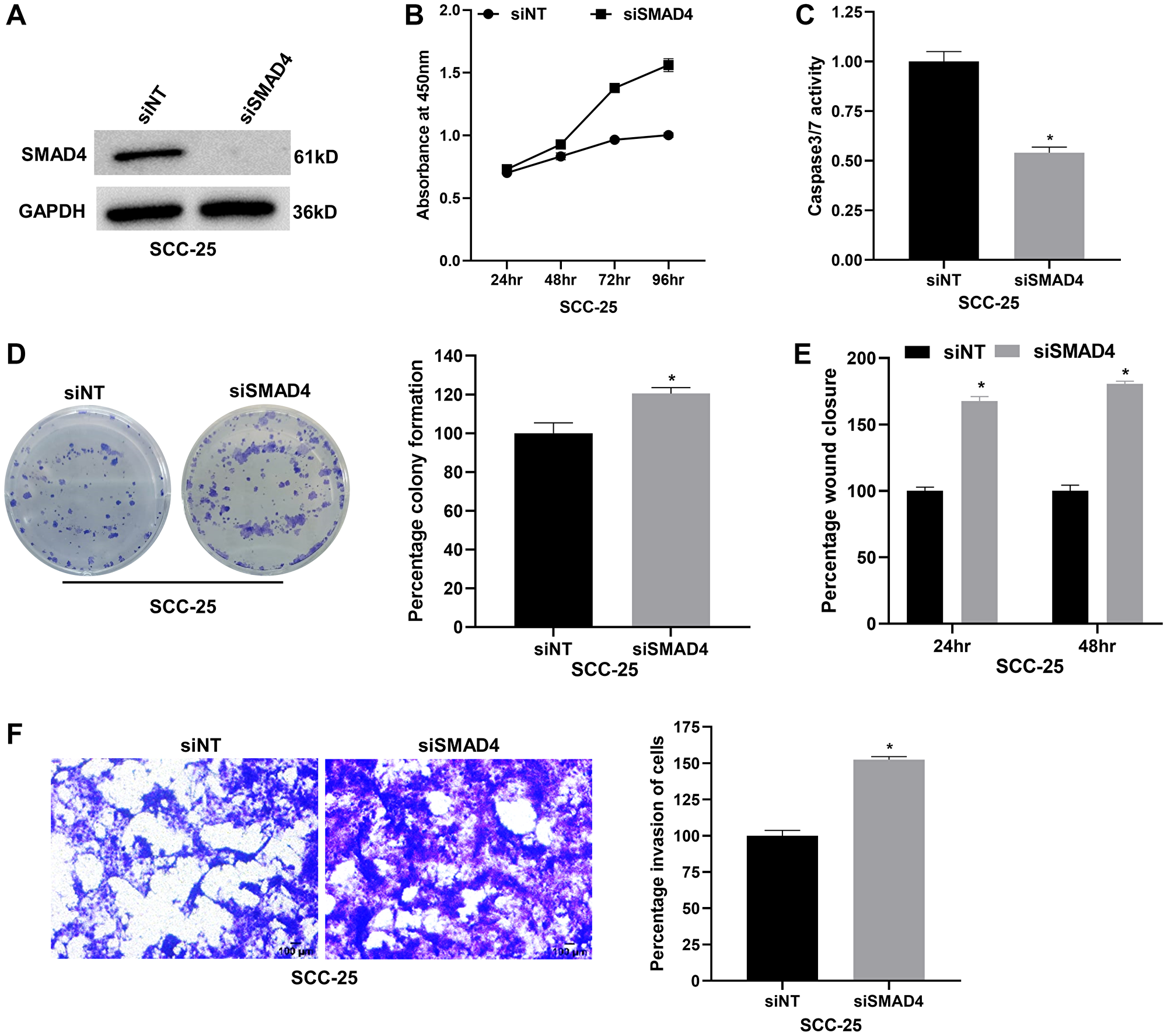 SMAD4 silencing promotes proliferation, migration, invasion and reduces apoptosis of the SCC-25 OSCC cell line in vitro