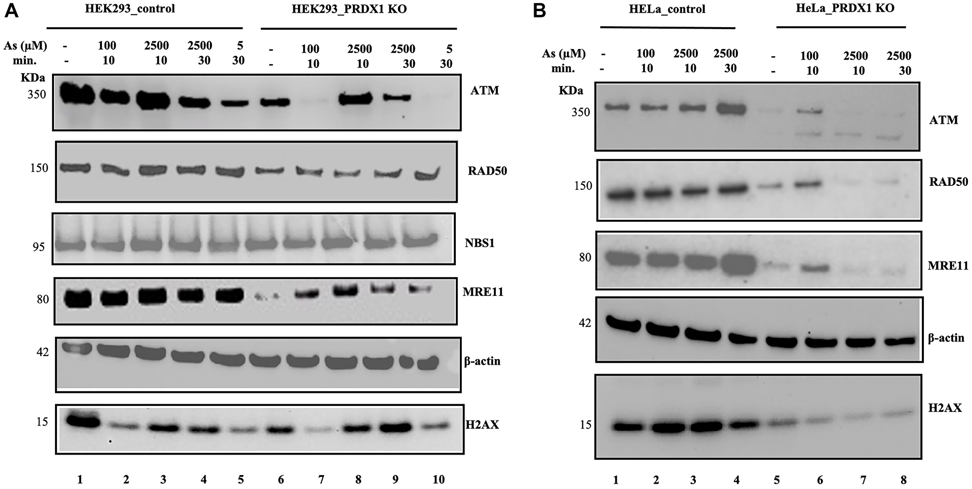 (A) Western blot showing ATM, RAD50, NBS1, MRE11, and H2AX protein levels in HEK293 control and HEK293