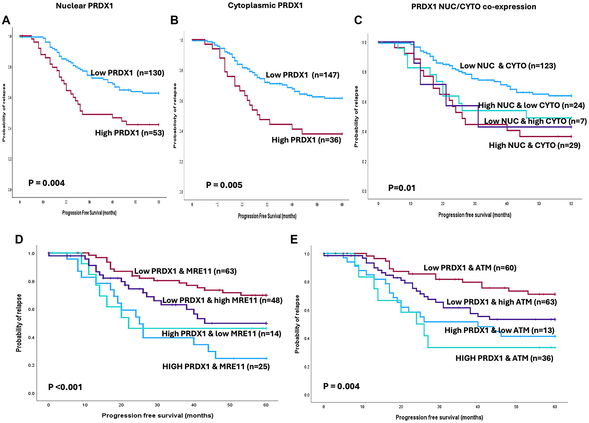 Kaplan-Meier survival analysis shows ovarian cancer progression-free survival and (A) PRDX1 nuclear expression. (B) PRDX1 cytoplasmic expression and (C) PRDX1 nuclear/cytoplasmic expression. (D) Kaplan-Meier survival analysis shows ovarian cancer progression-free survival and PRDX1/MRE11 co-expression. (E) Kaplan-Meier survival analysis shows ovarian cancer progression-free survival and PRDX1/ATM co-expression.