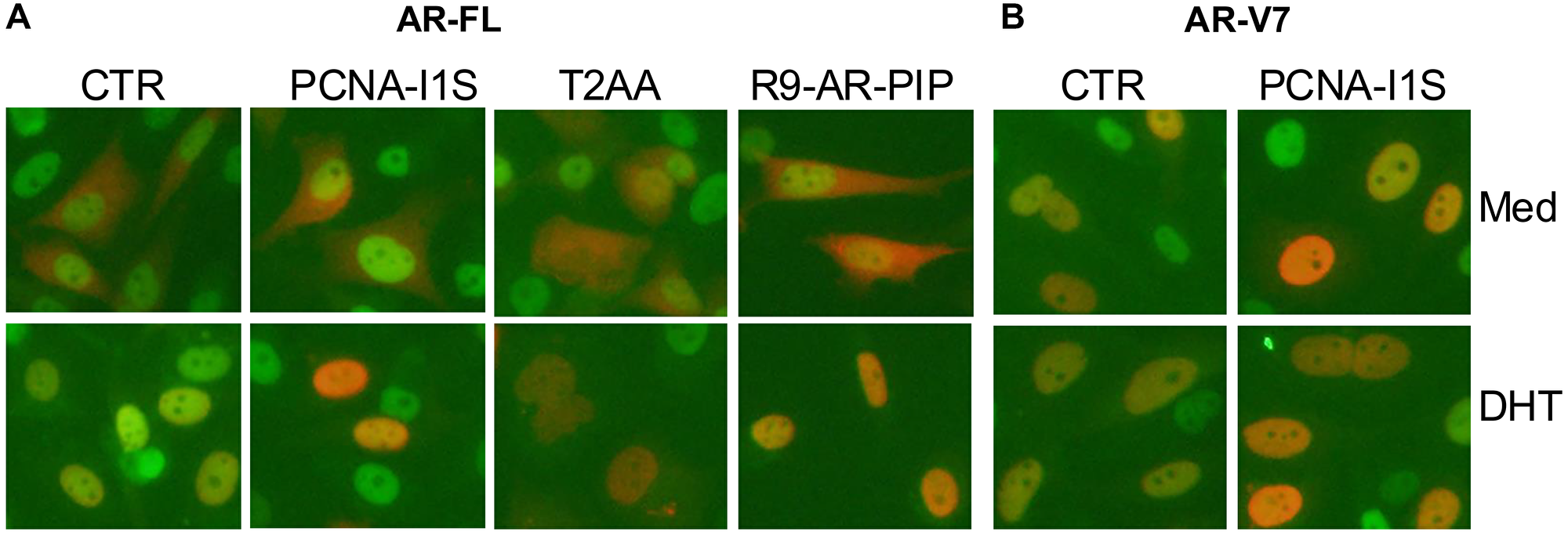 Colocalization of AR-FL and AR-V7 with PCNA