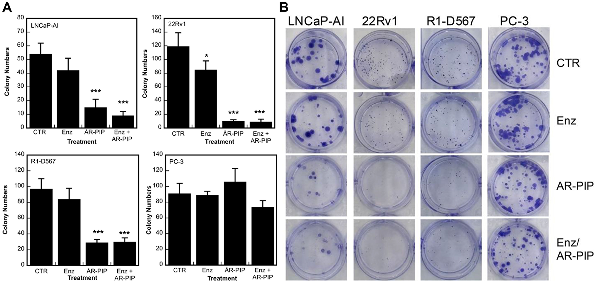 The differential cytotoxic effects of PCNA inhibitors in prostate cancer cells varying with AR expression status