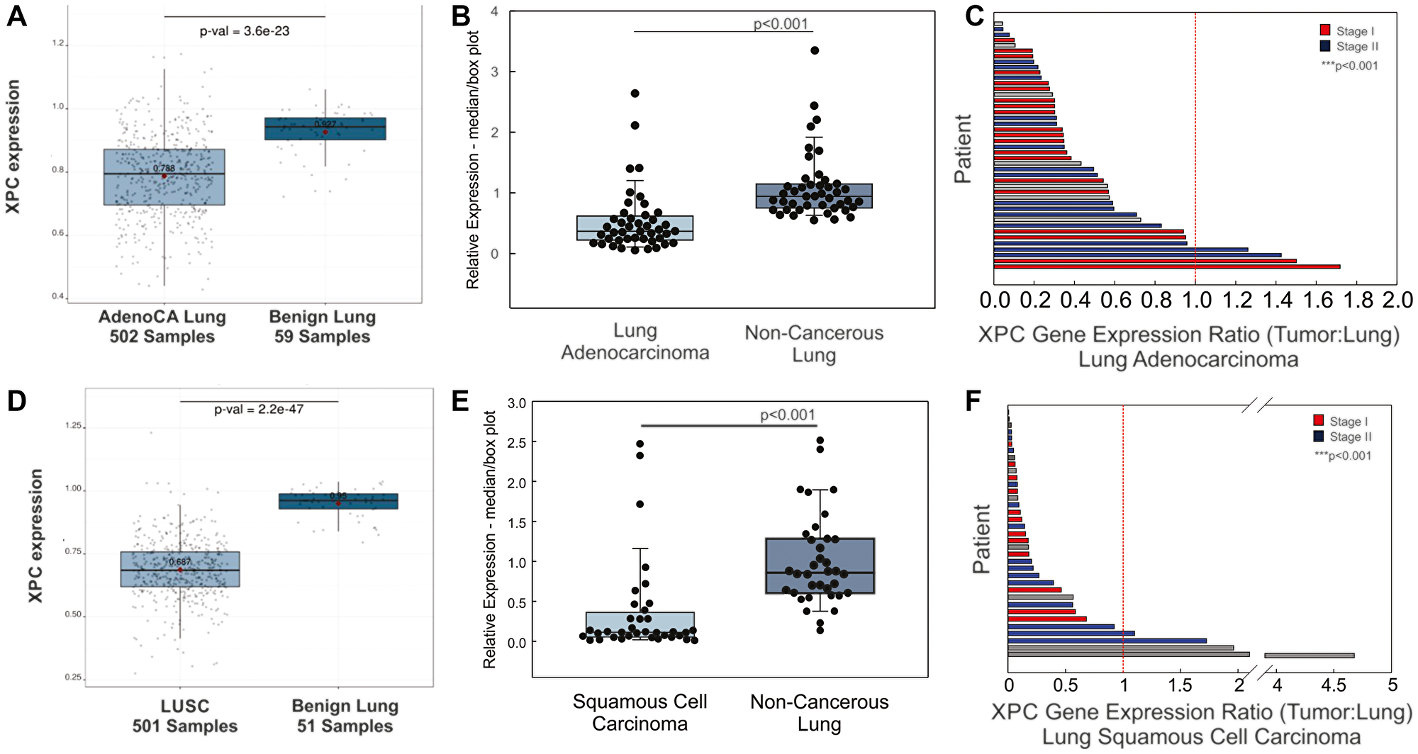 XPC gene expression is decreased in human non-small cell lung cancers compared to normal subject-matched lung