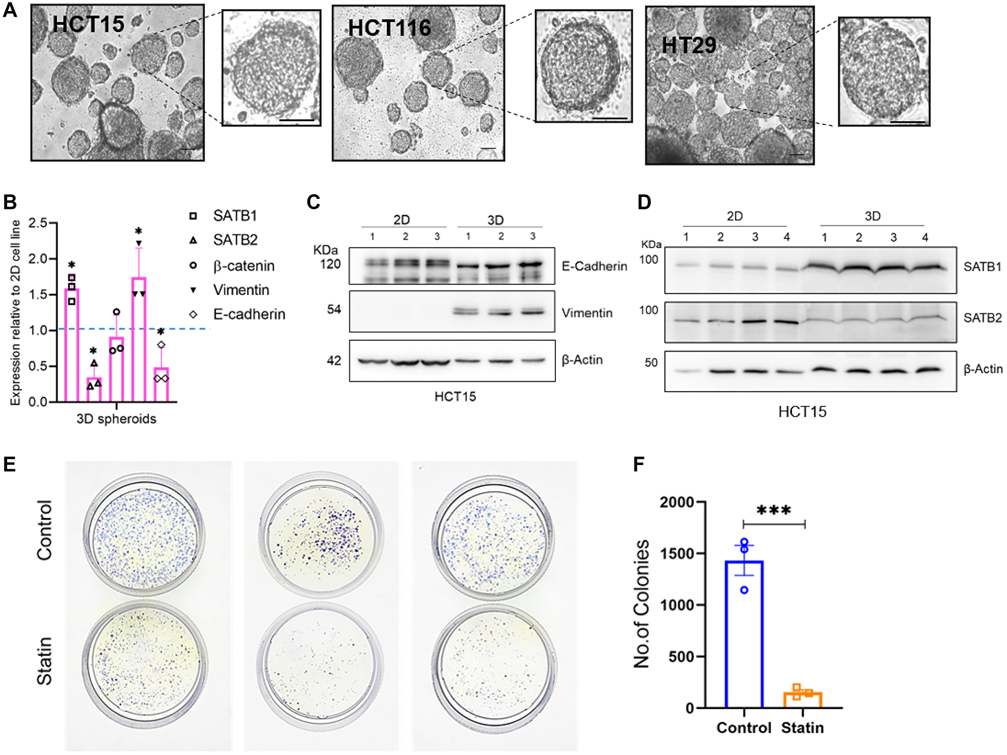 3D spheroids of CRC cells recapitulate the EMT phenotype better than 2D cell cultures