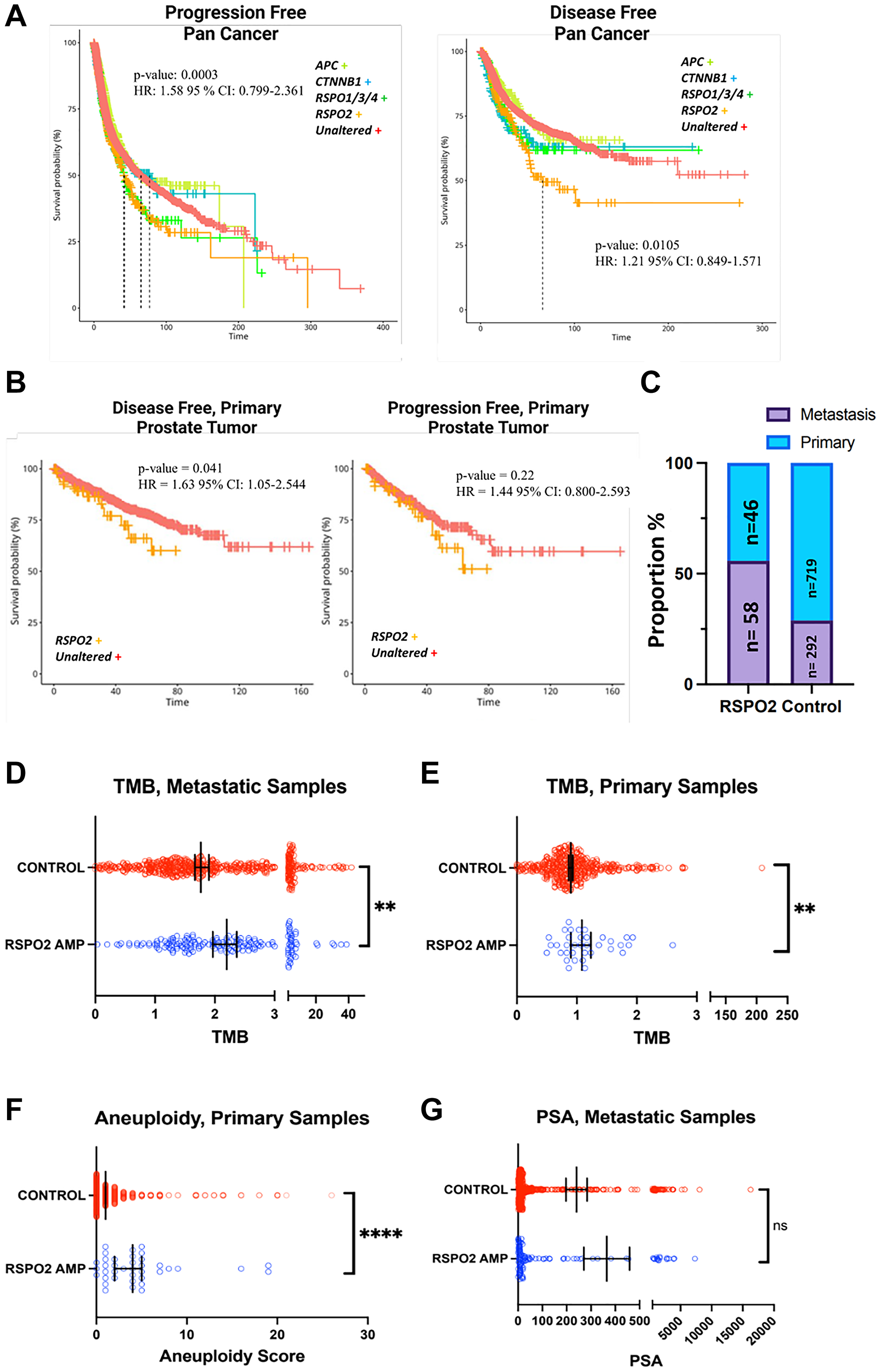(A) Samples with annotated disease-free (n = 5,383) and progression-free (n = 10,613) survival are shown for cancer patients from the TCGA Pan Cancer Atlas based on if they have alterations in RSPO2 (orange), CTNNB1 (teal), APC (green), or the unaltered group (red). (B) TCGA PC samples were analyzed for disease or progression-free survival (n = 489) based on whether they had an RSPO2 amplification (orange) as compared to the control (red) group. (C) In an aggregate of 16 PC studies, the proportion of tumors with and without RSPO2 amplifications is depicted based on metastatic samples or primary samples. (D) TMB is shown for control or samples with RSPO2 alterations based on mCRPC samples from cBioPortal (SU2C [33]). Of samples in the TCGA PC study, control and samples with RSPO2 alterations are analyzed for their status in (E) TMB, (F) aneuploidy scores. (G) PSA levels are depicted for samples with or without RSPO2 alterations based on an aggregate of metastatic prostate cancer samples (FHCRC [33, 35], SU2C, Eur Urol 2017 [34], PRAD Broad [36]).