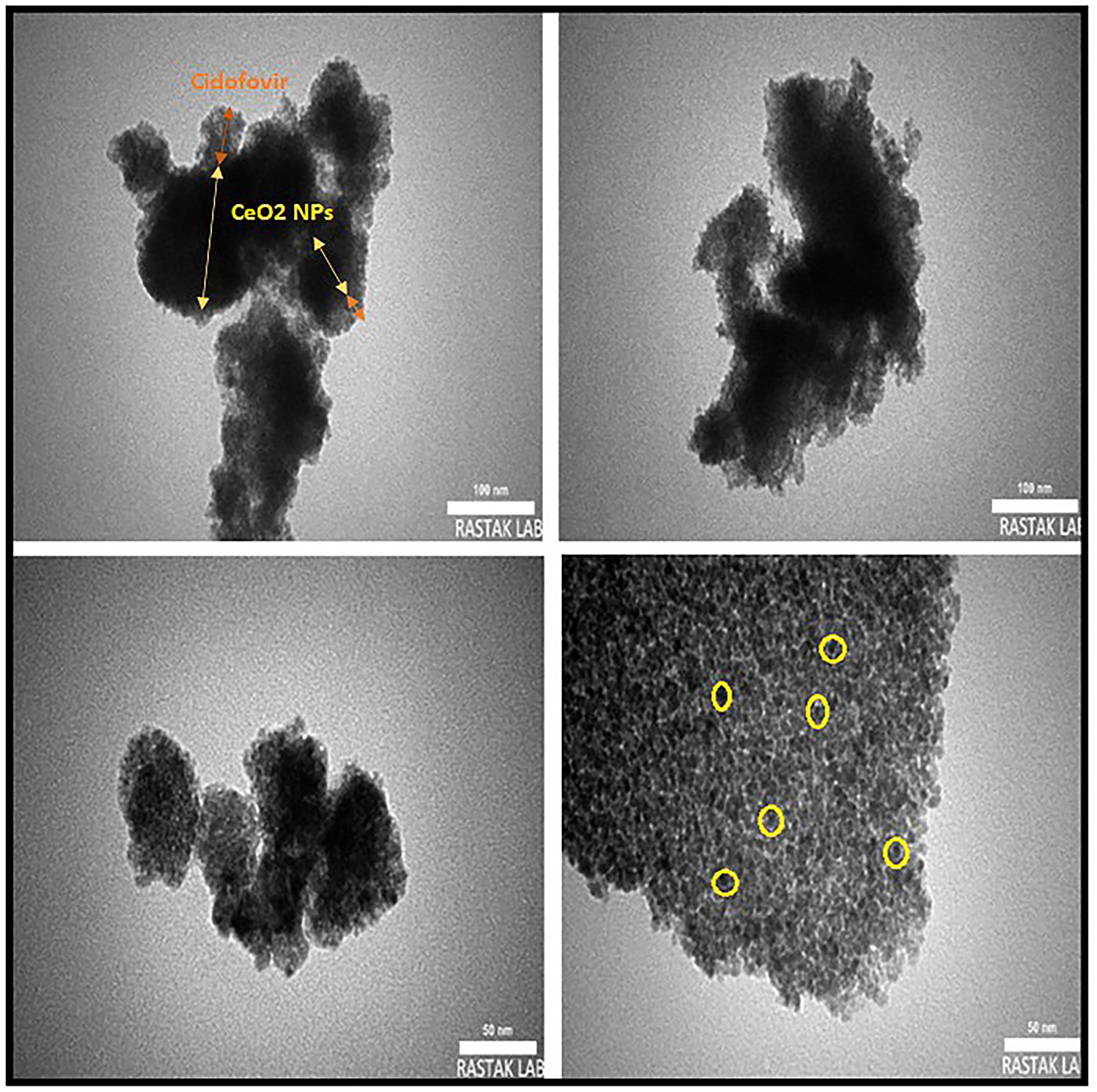 TEM images of CDV-CeO2 NPs with different magnification