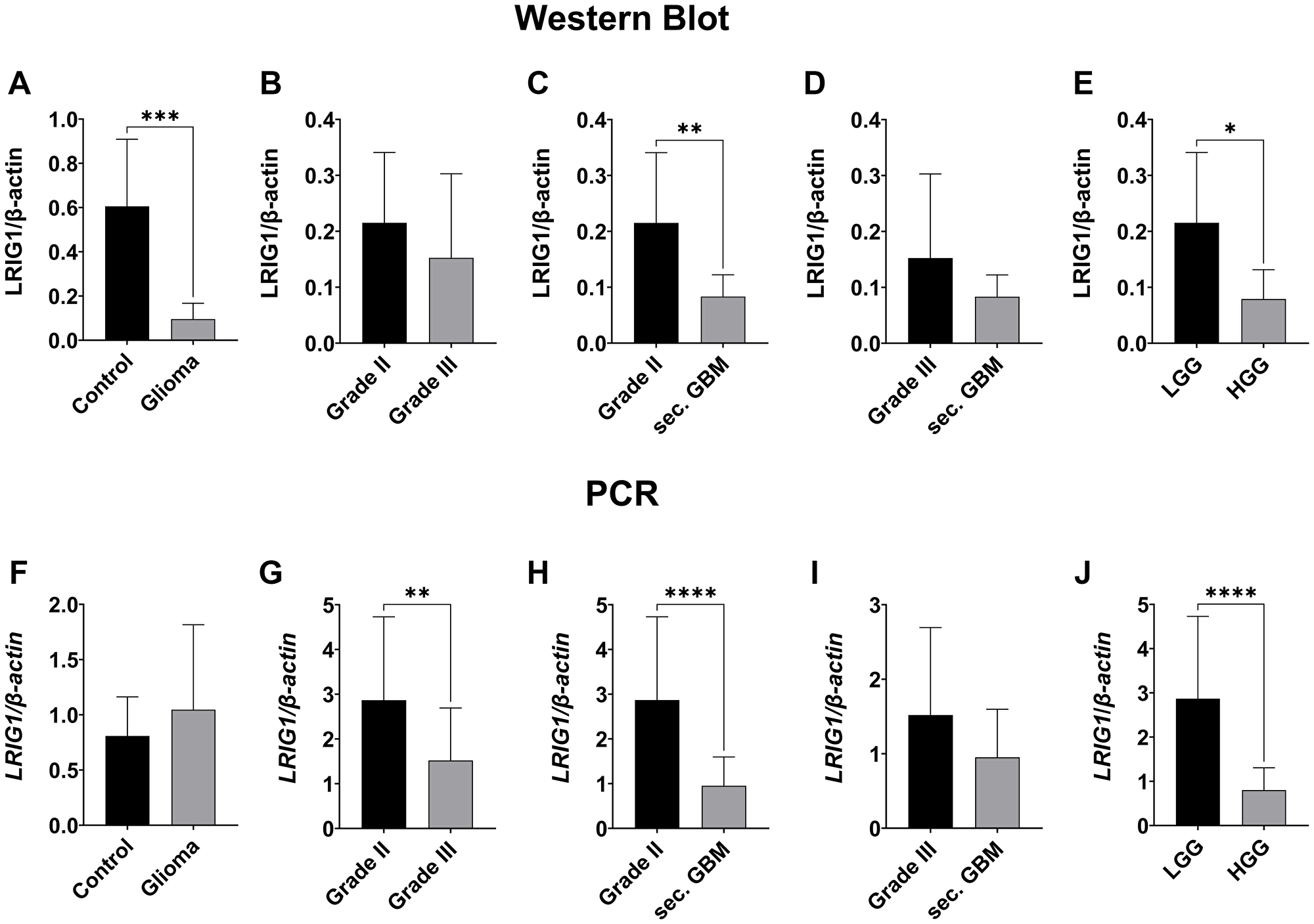 LRIG1 expression negatively correlates with WHO grades of gliomas