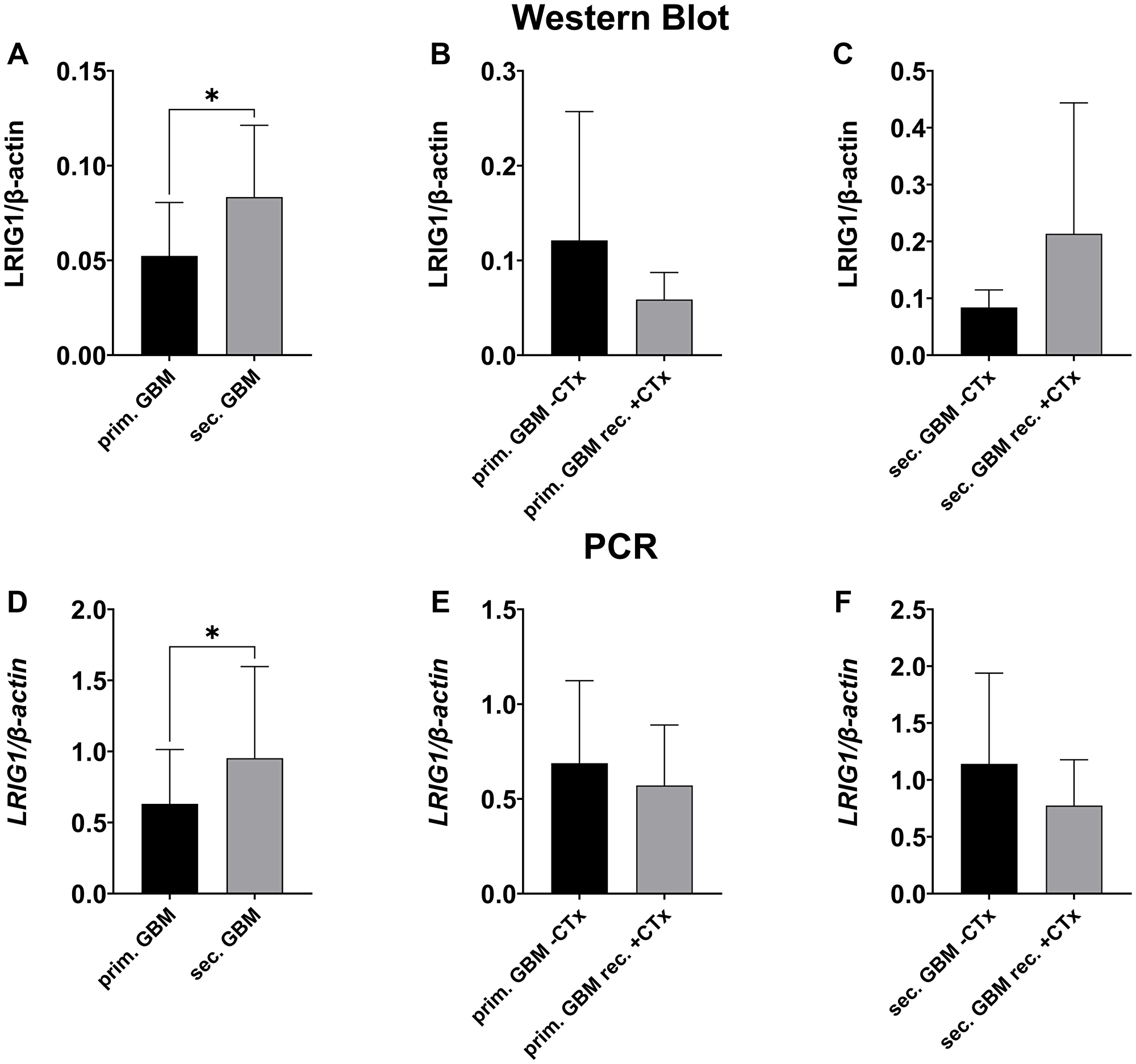 LRIG1 expression in primary vs. secondary GBMs before and after temozolomide treatment