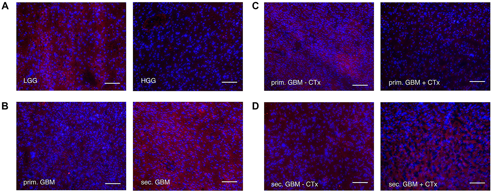 Immunofluorescence staining of LRIG1 (alexaflour555 in red = LRIG1, Blue = DAPI