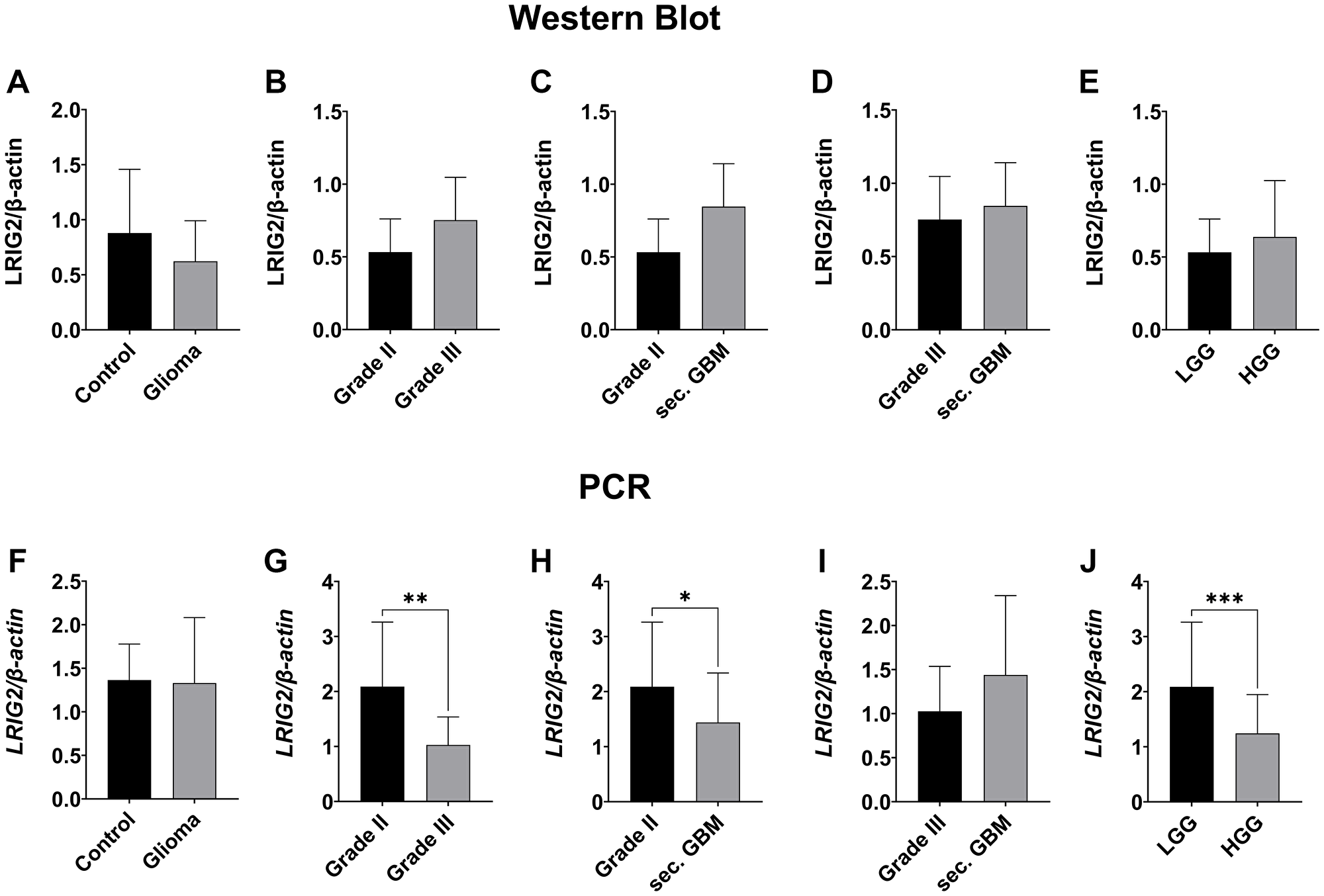 LRIG2 expression in different grades of gliomas measured by western blot and qPCR