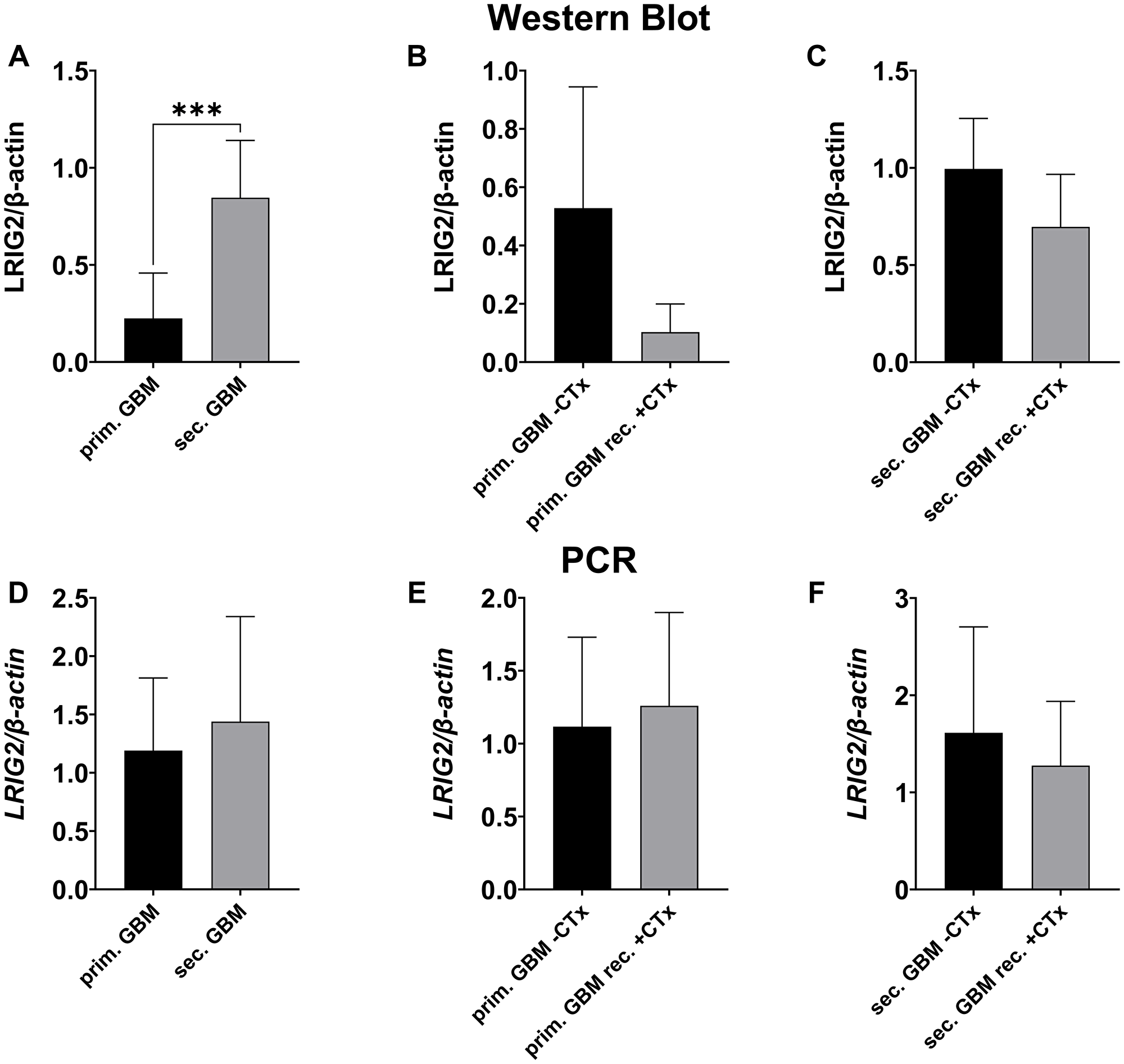 LRIG2 expression in primary vs. secondary GBMs and in GBMs with vs. without chemotherapy treatment