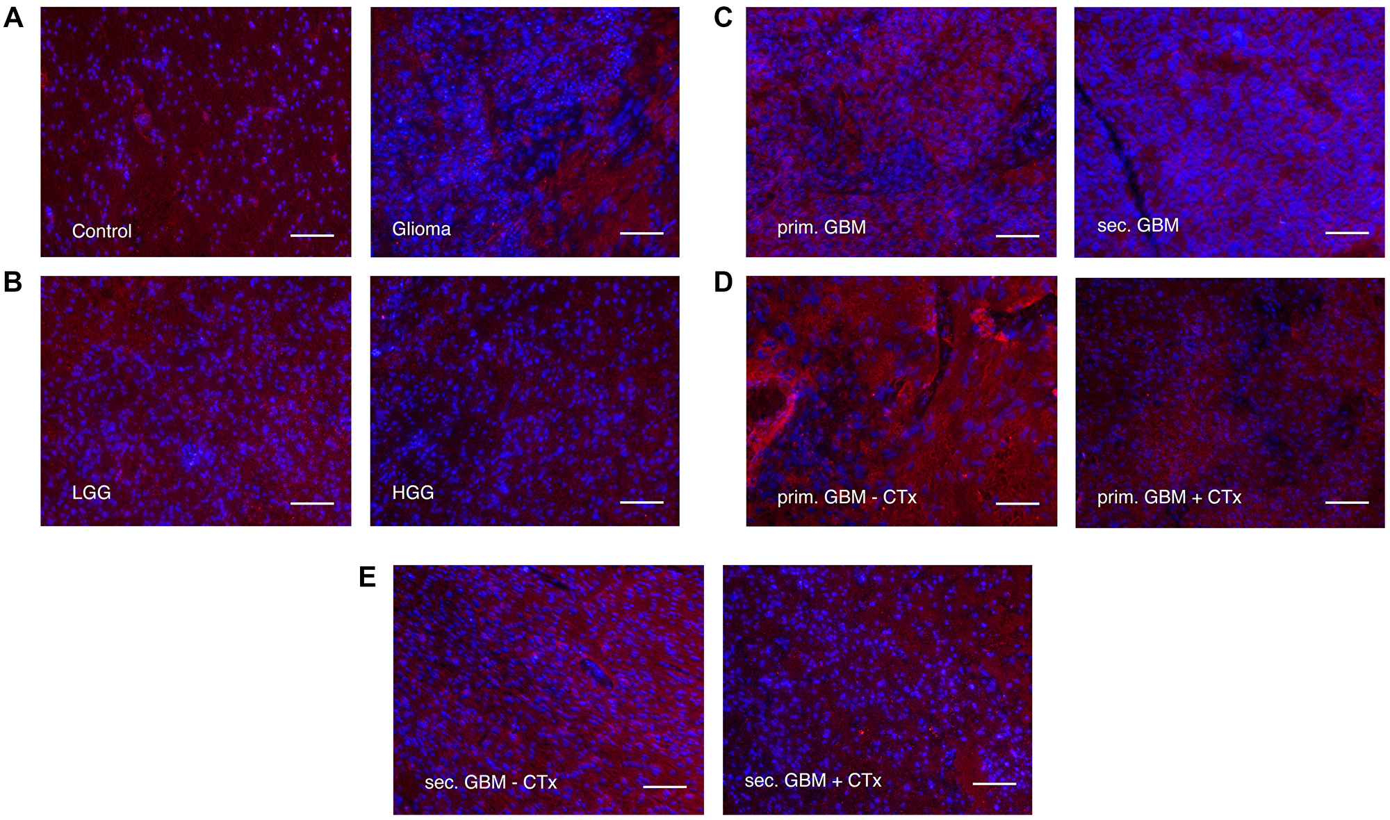 Immunofluorescence staining of LRIG3 (alexaflour555 in red = LRIG3, Blue = DAPI