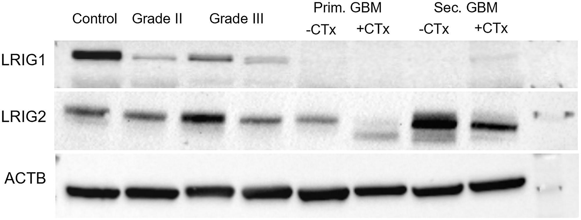 Representative western blot of LRIG1 and LRIG2
