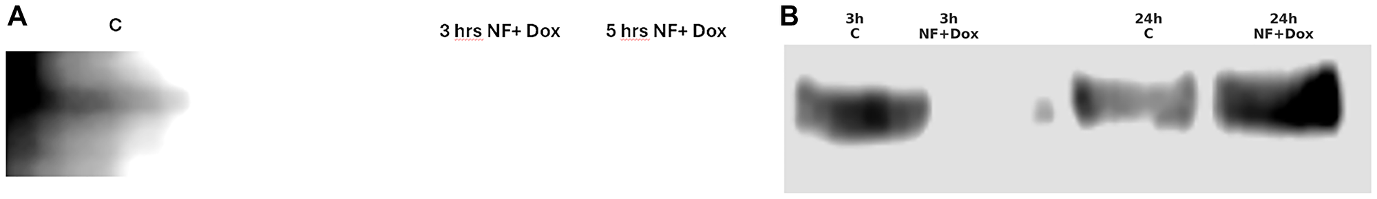 (A) Nuclear extracts from PANC-1 cells were immunoprecipitated with an anti-c-Jun antibody and analyzed by Western blotting using anti-ST2 antibody. In untreated cells, nuclear ST2 was bound to immunoprecipitated c-Jun. This interaction was strongly reduced after 3 h of Nerofe+ldDox treatment. (B) By 24 h, the ST2–c-Jun interaction re-formed, indicating a reversible and dynamic inhibitory mechanism. These findings were validated with two independent anti-ST2 antibodies, confirming the specificity of the nuclear ST2–c-Jun interaction.