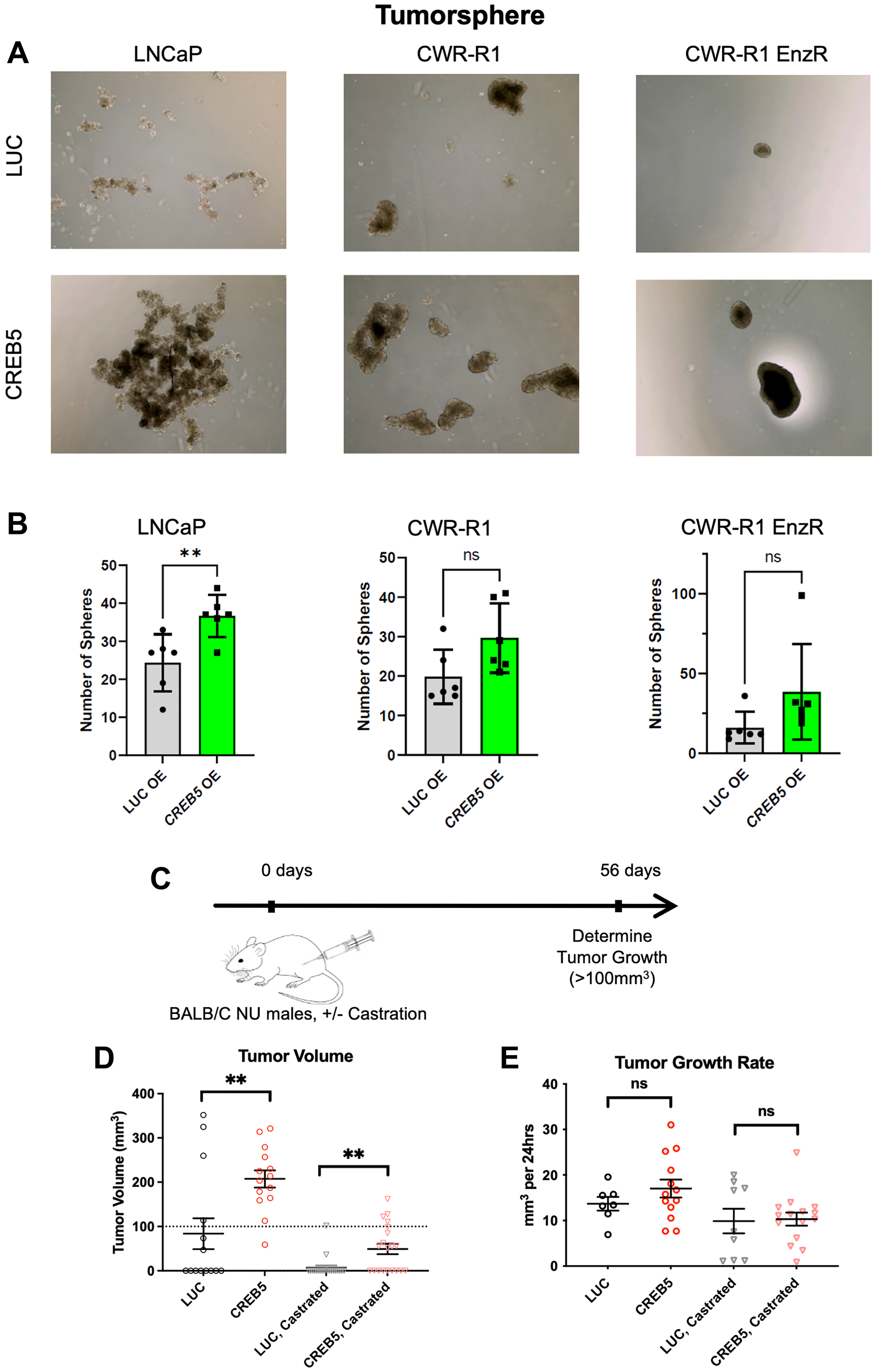 (A) Tumorsphere formation assay with six replicates performed in AR-positive prostate cancer (LNCaP), CRPC-like (CWR-R1), and CRPC-like enzalutamide-resistant (CWR-R1 EnzR) cell lines with CREB5 or LUC overexpression, (B) quantified by tumorsphere number with statistical comparisons done via Mann-Whitney tests. Error bars represent mean ± SD. *p $!--ESC