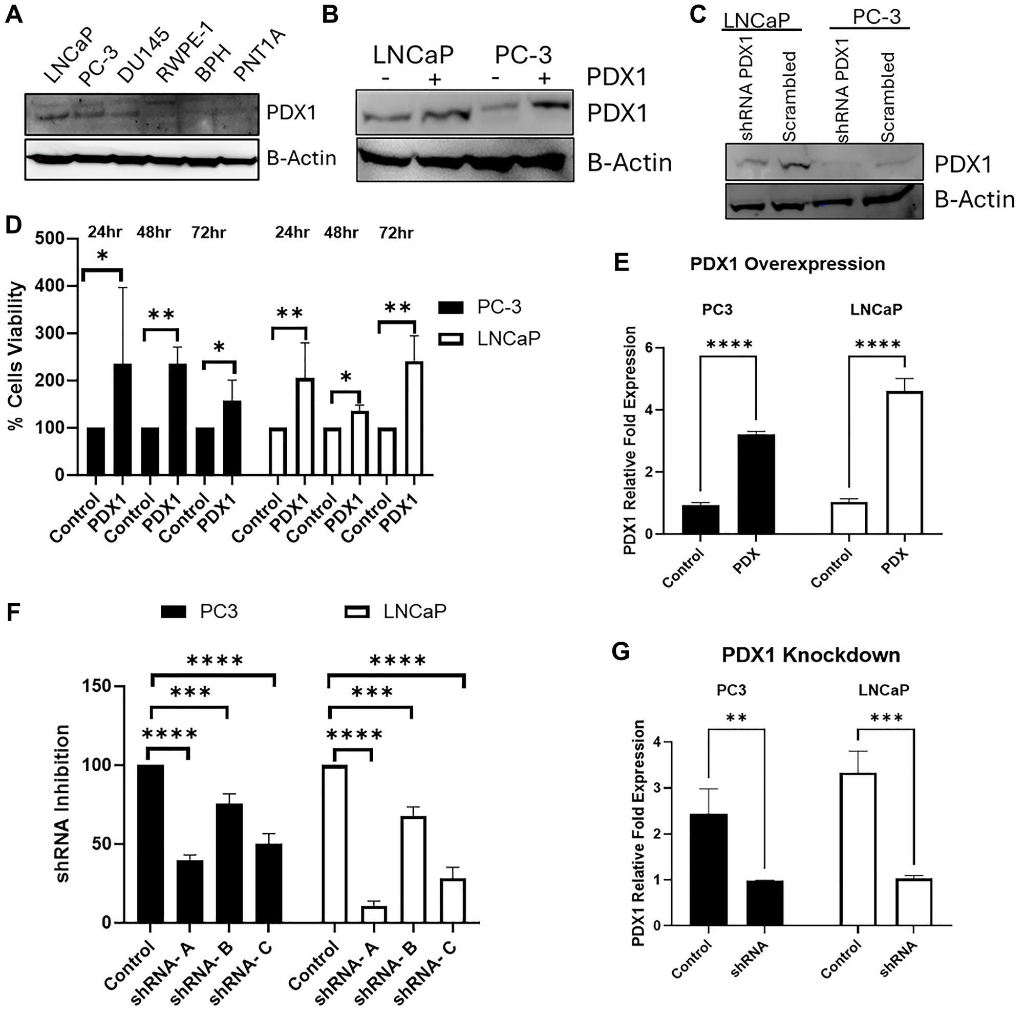 PDX1 expression and functional impact on prostate cancer cell viability