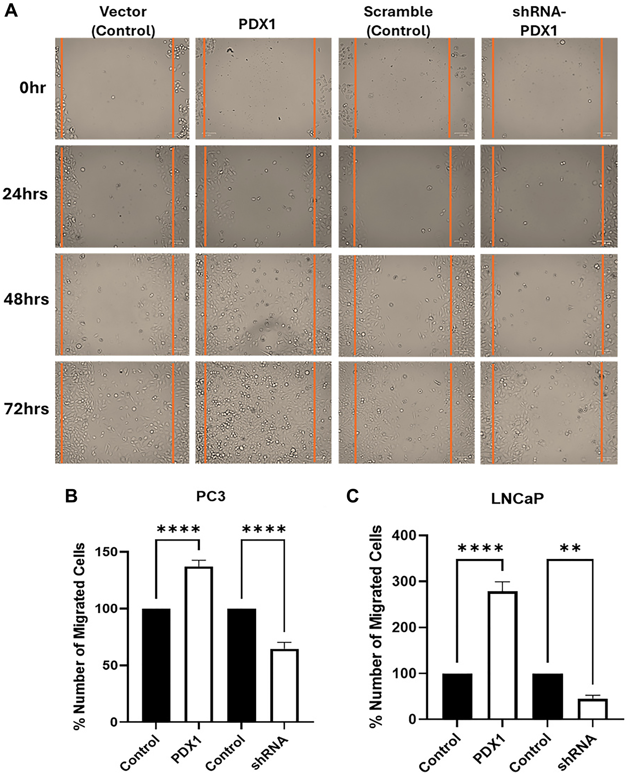 PDX1 expression and prostate cancer cell migration analysis