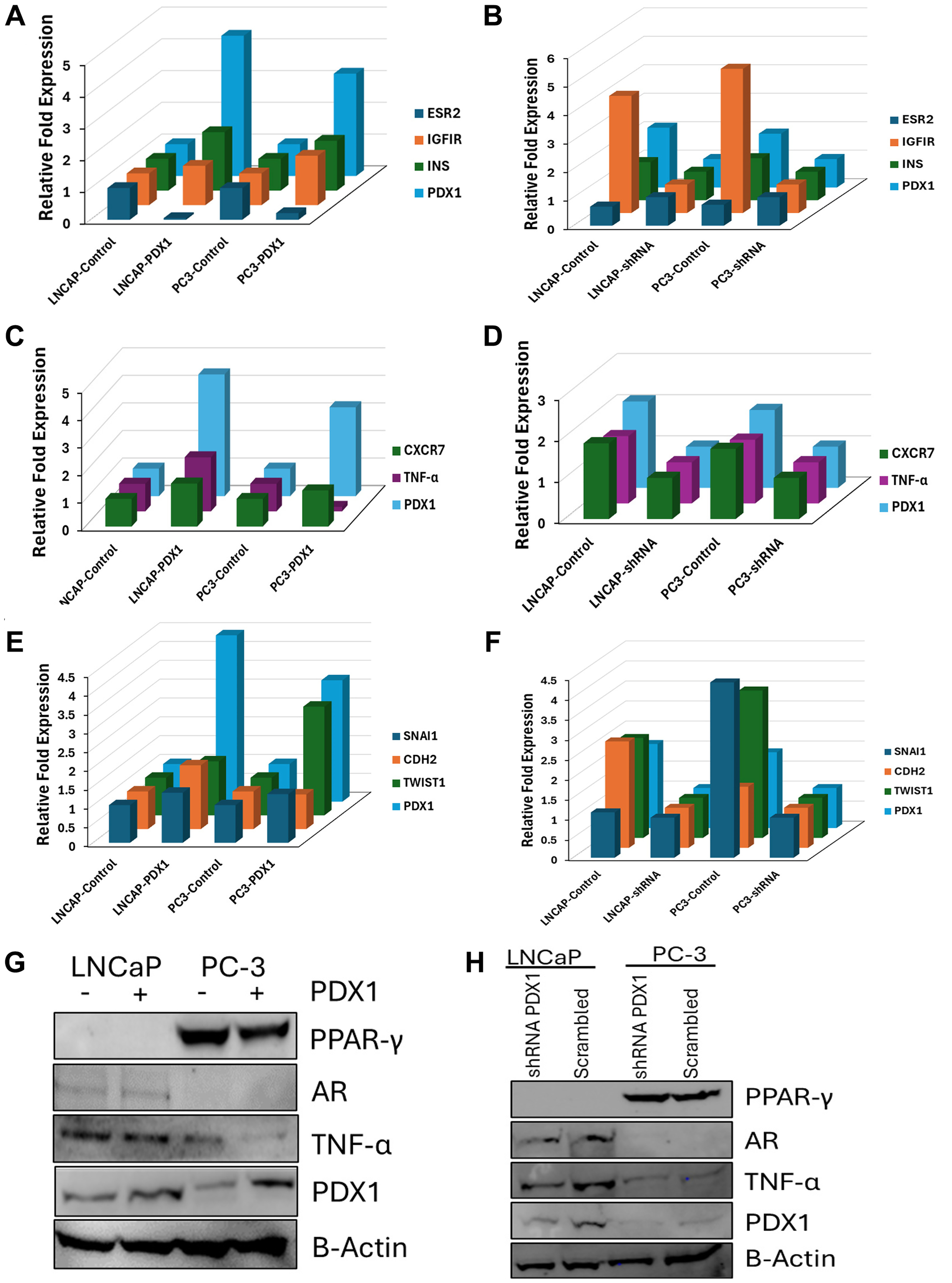 PDX1 modulates intermediates in insulin signaling, inflammatory, and EMT pathways in prostate cancer cells