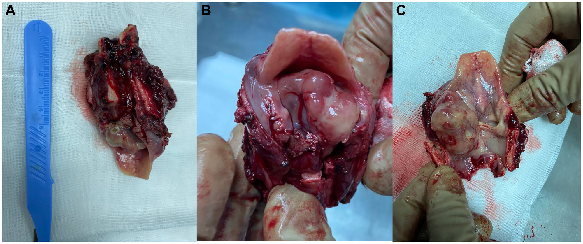 Macroscopic preparation of the larynx