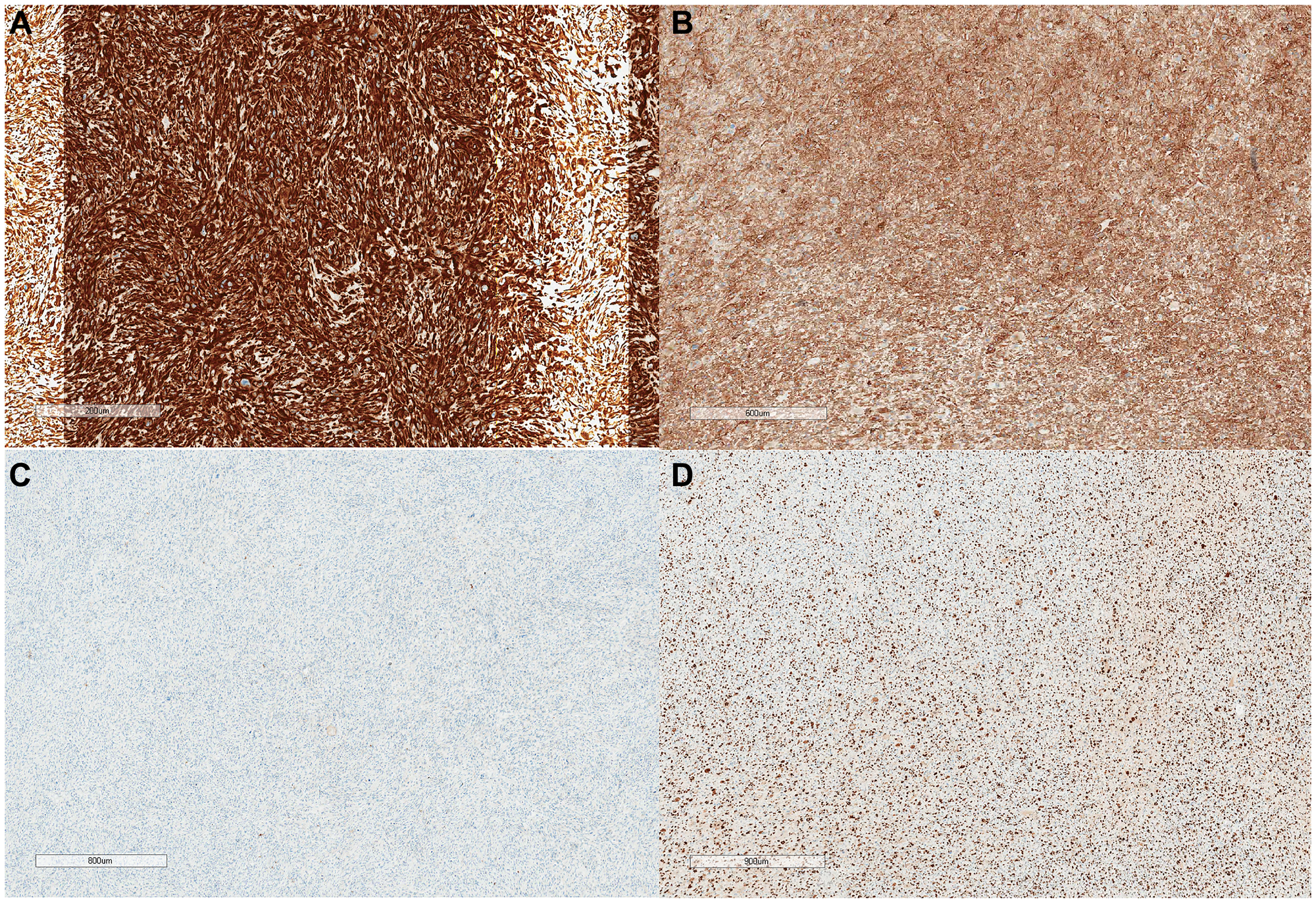 IHC study x20