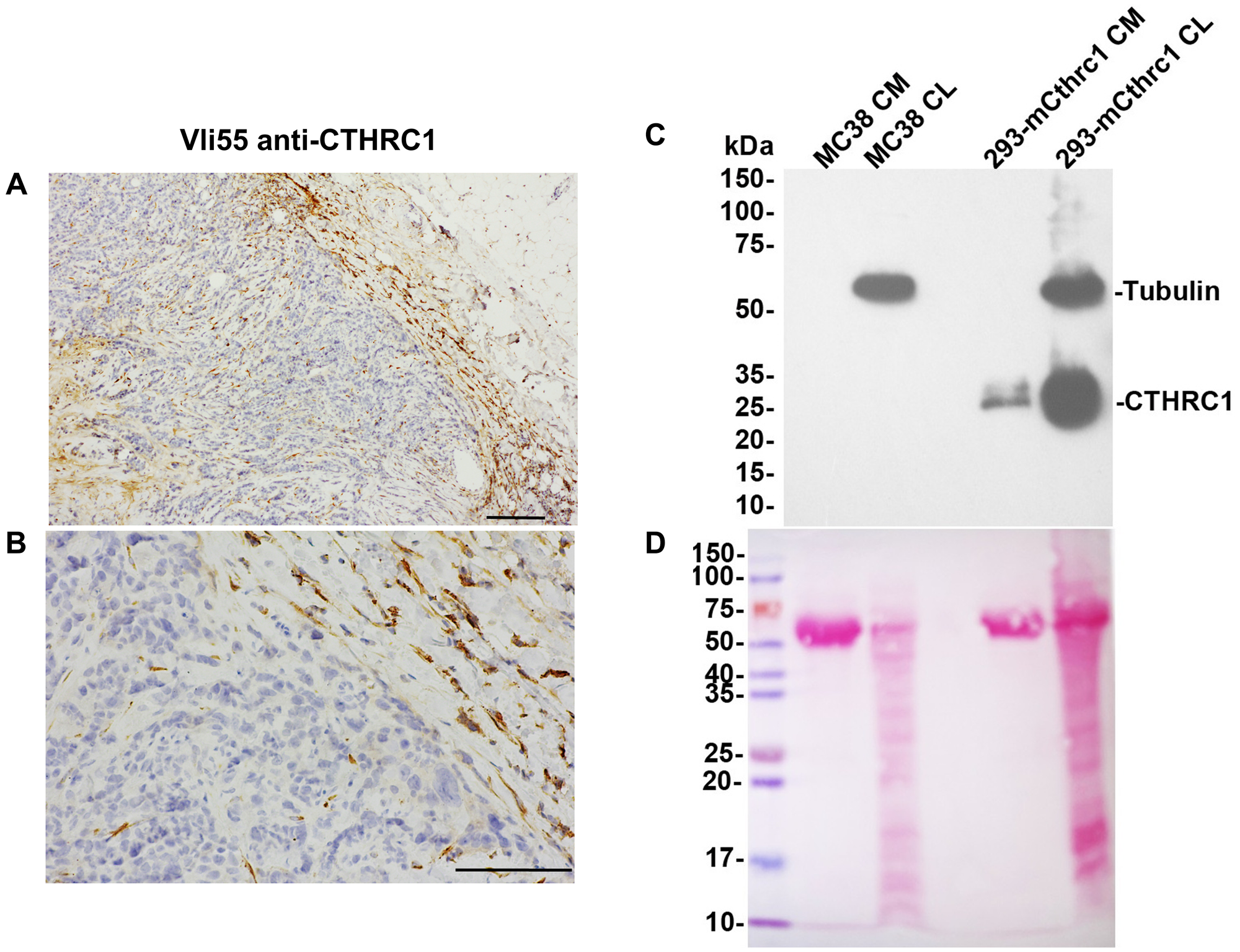 CTHRC1 is not detected in human colorectal tumor cells or MC38 cells