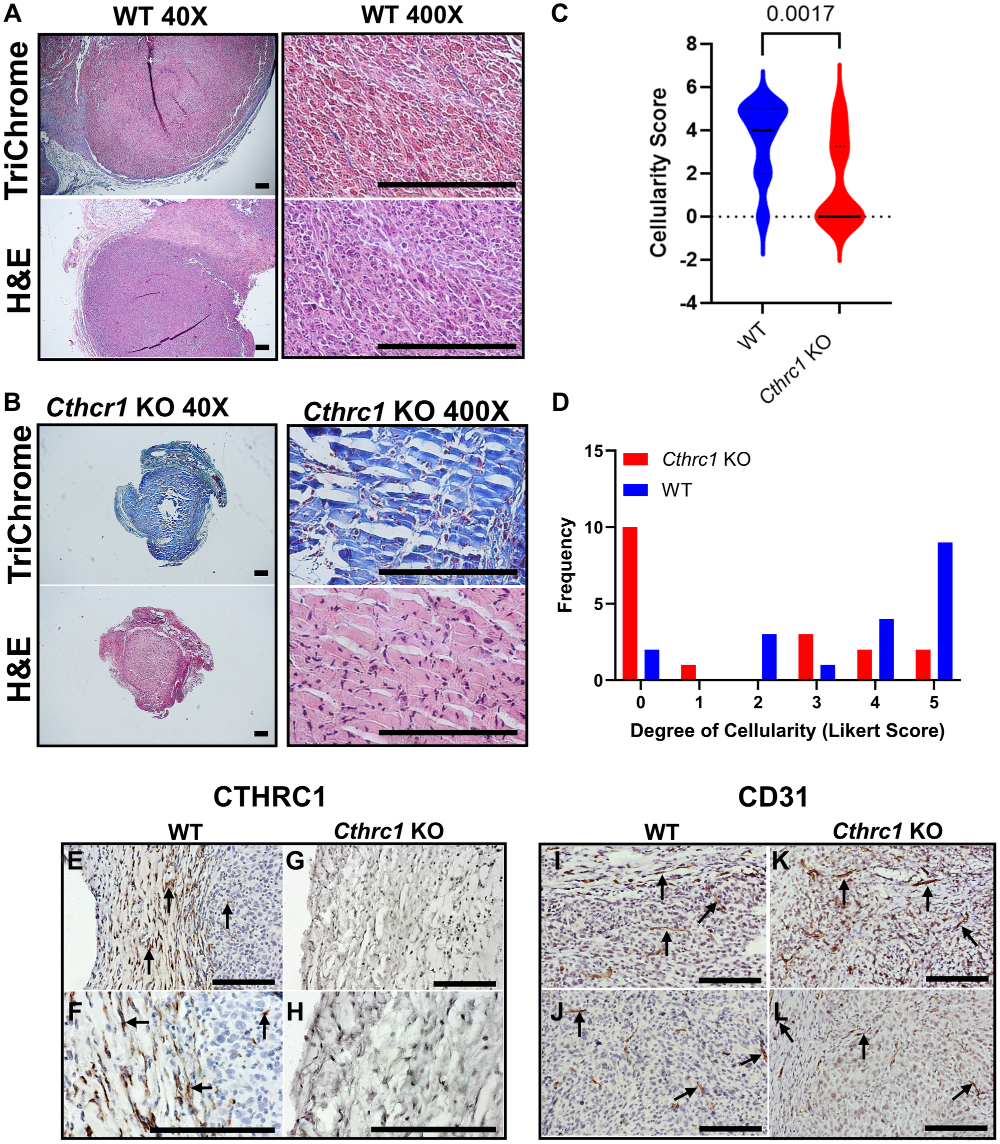 Histological staining reveals Cthrc1 KO alters tumor microarchitecture and cellularity