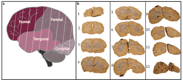 fig2