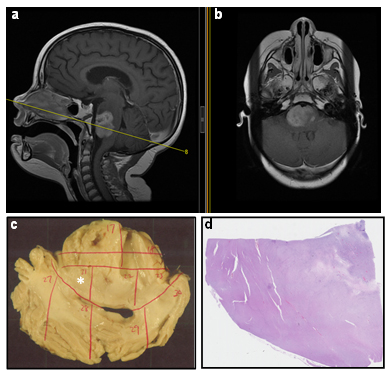 fig3