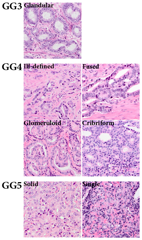 fig1