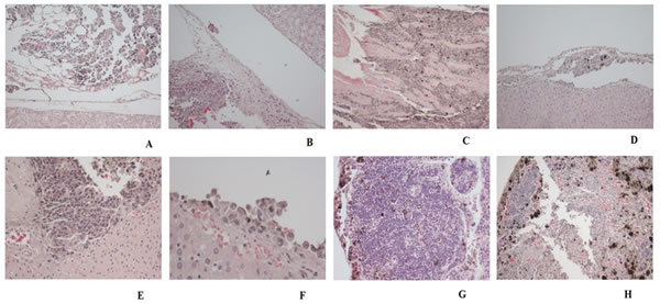 fig11