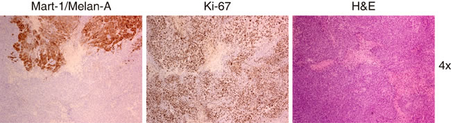 fig11